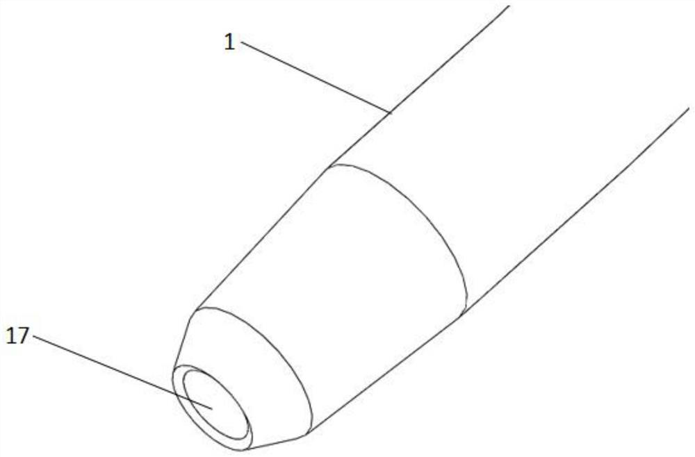 A subcutaneously implanted biliary drainage tube