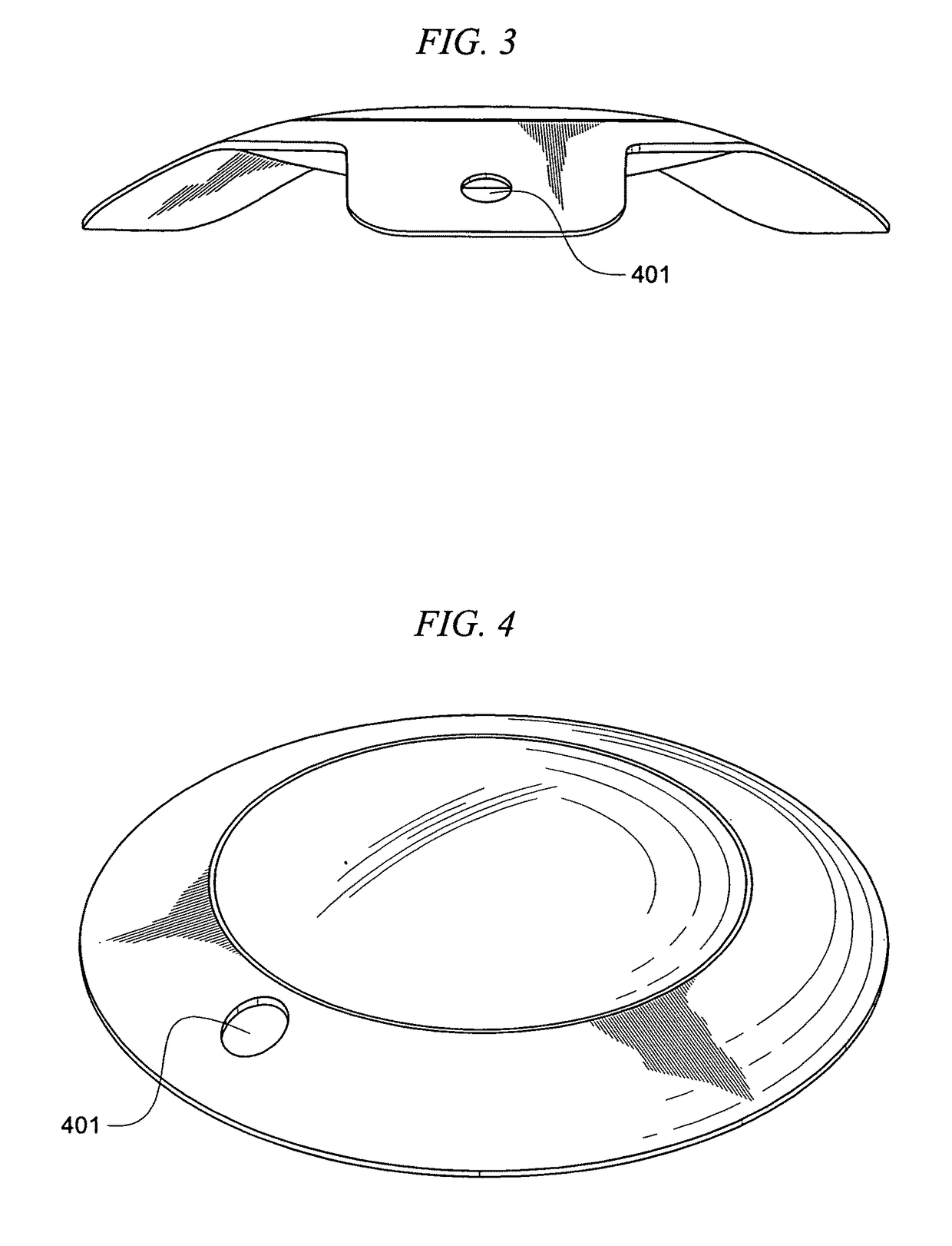 Multilens intraocular lens system with injectable accommodation material