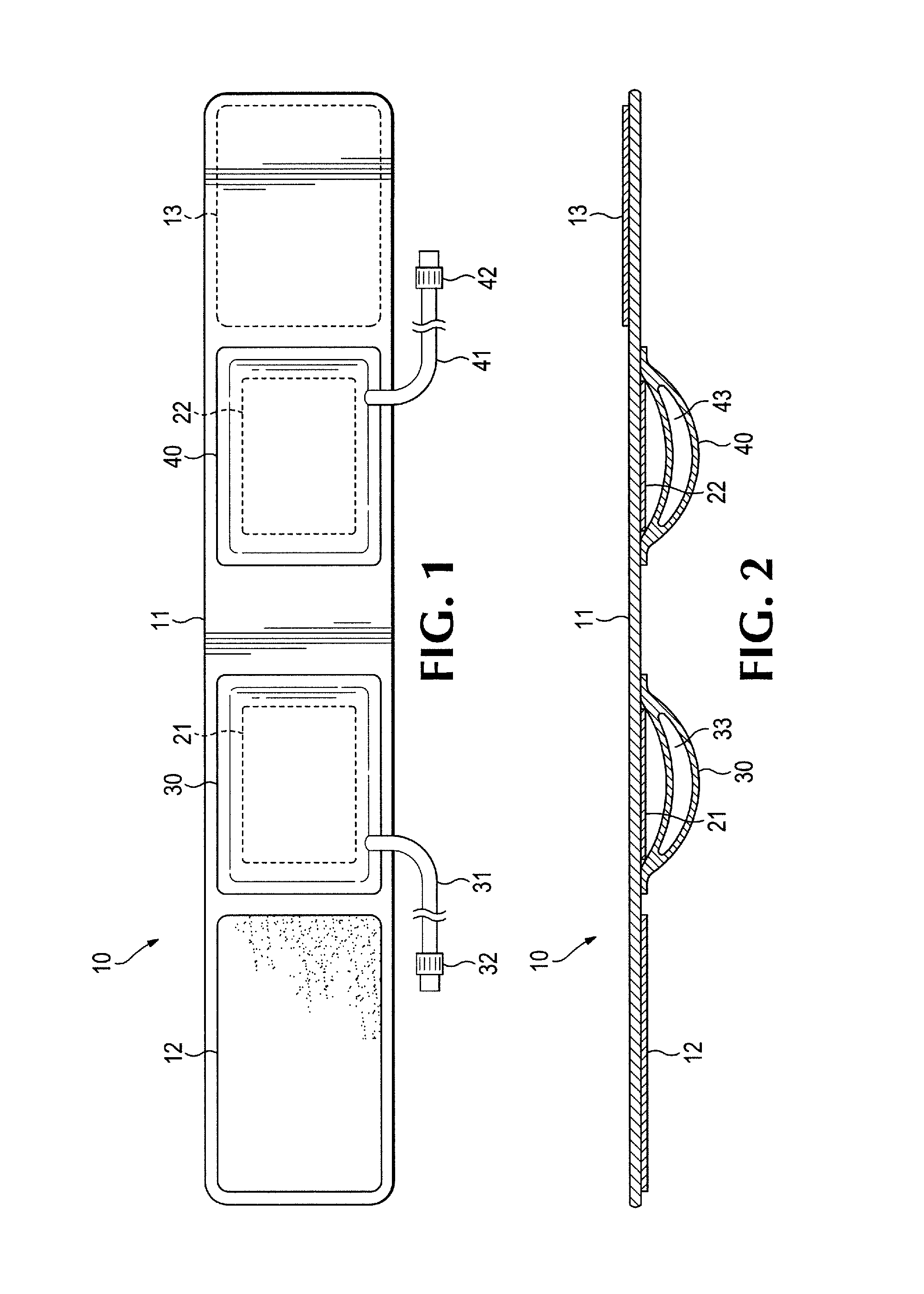 Apparatus and method of use for an adjustable radial and ulnar compression wristband