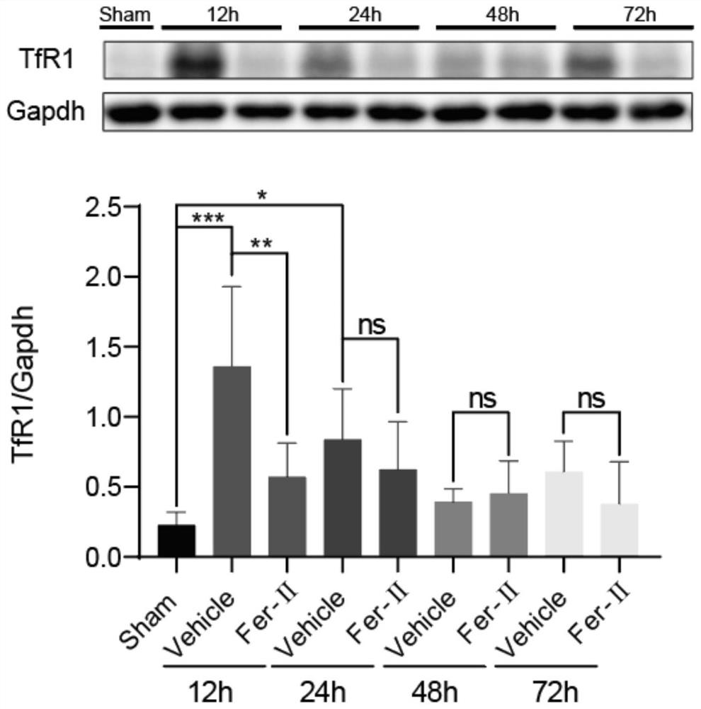 Application of transferrin receptor inhibitor Ferristatin-II in preparation of medicine for treating cerebral trauma