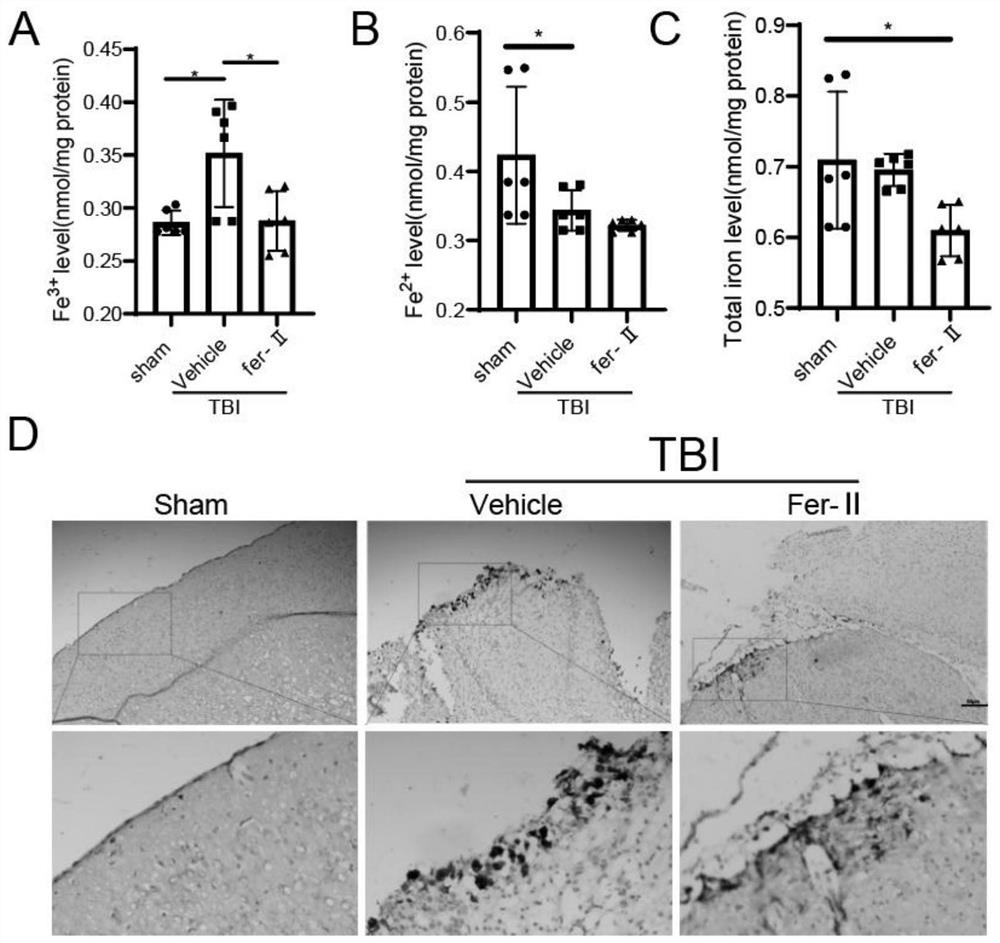 Application of transferrin receptor inhibitor Ferristatin-II in preparation of medicine for treating cerebral trauma