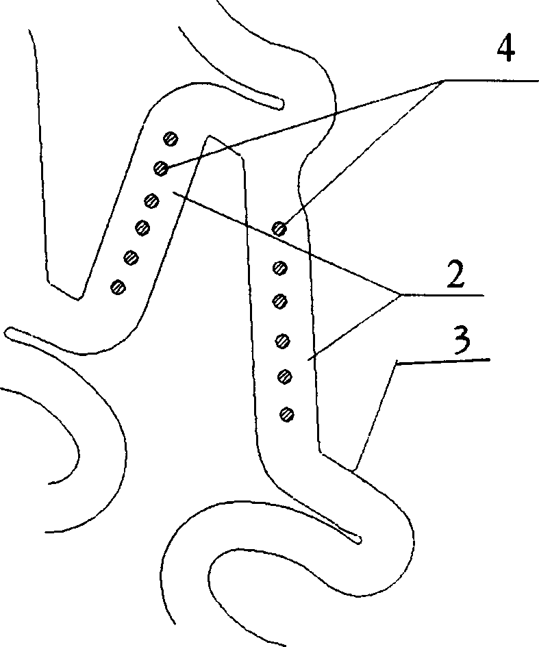 Vascular stent mounted with non penetrable slot or blind hole and its preparing method