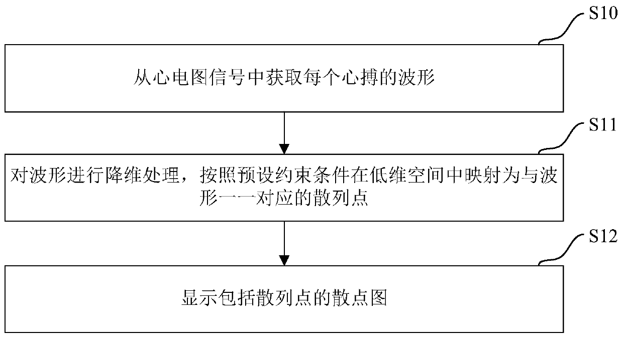 Method for displaying electrocardiogram data and terminal equipment