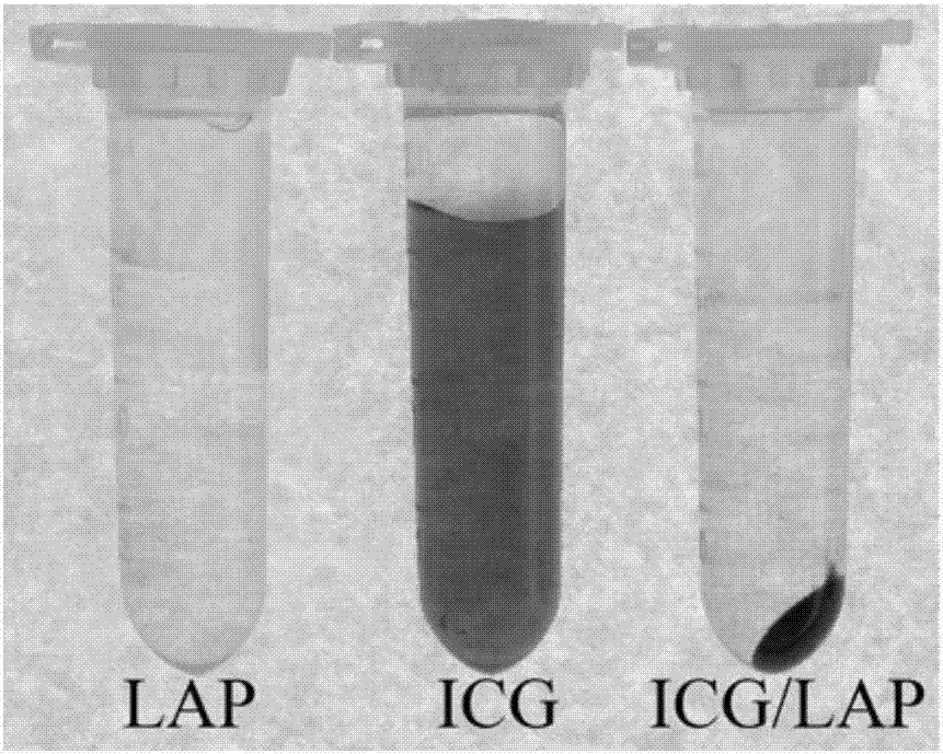 Preparation method of laponite nanoparticles ICG (Indocyanine Green)/LAP (Laponite) supporting the ICG
