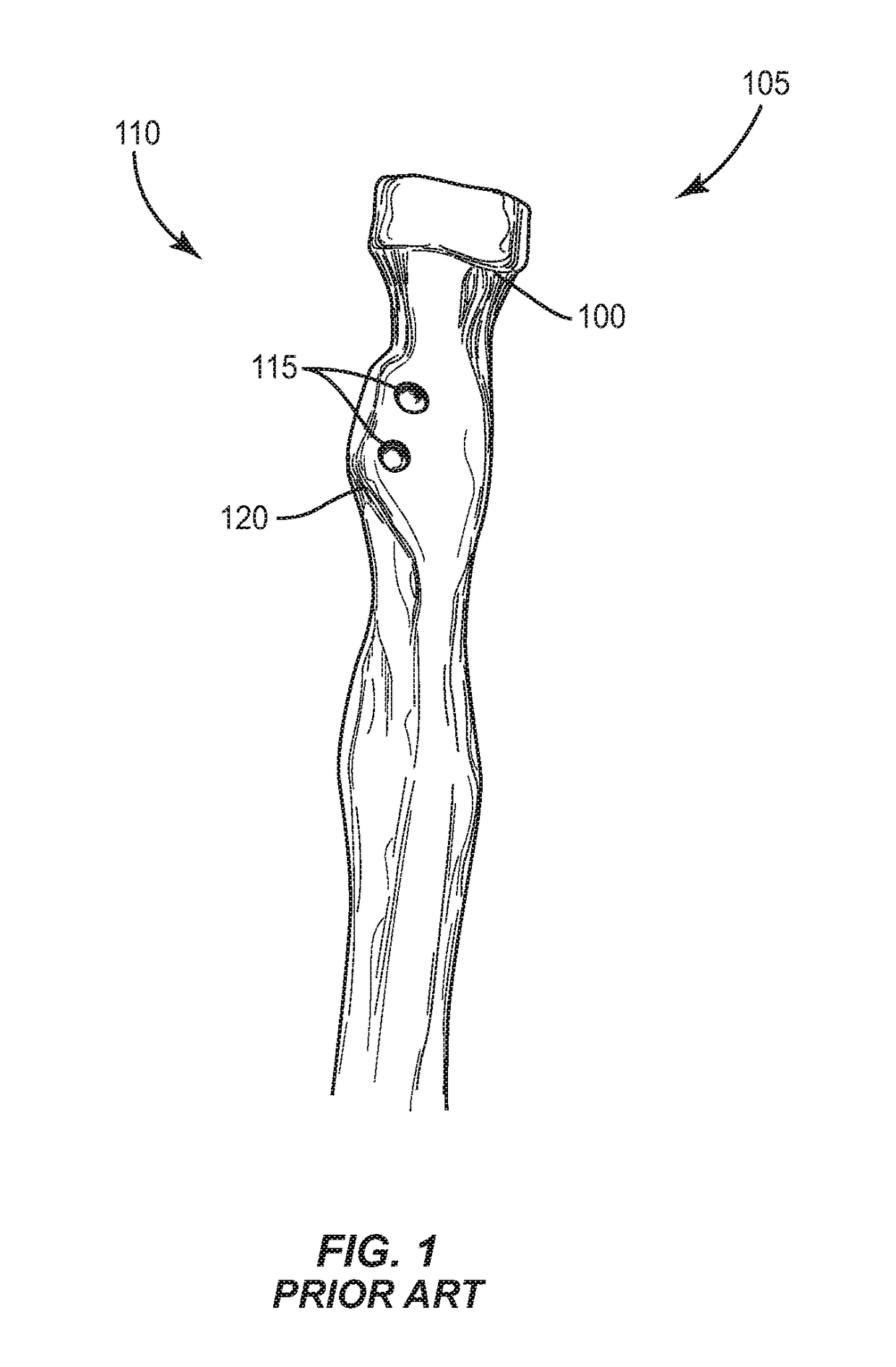 Surgical Anchor and Method of Use
