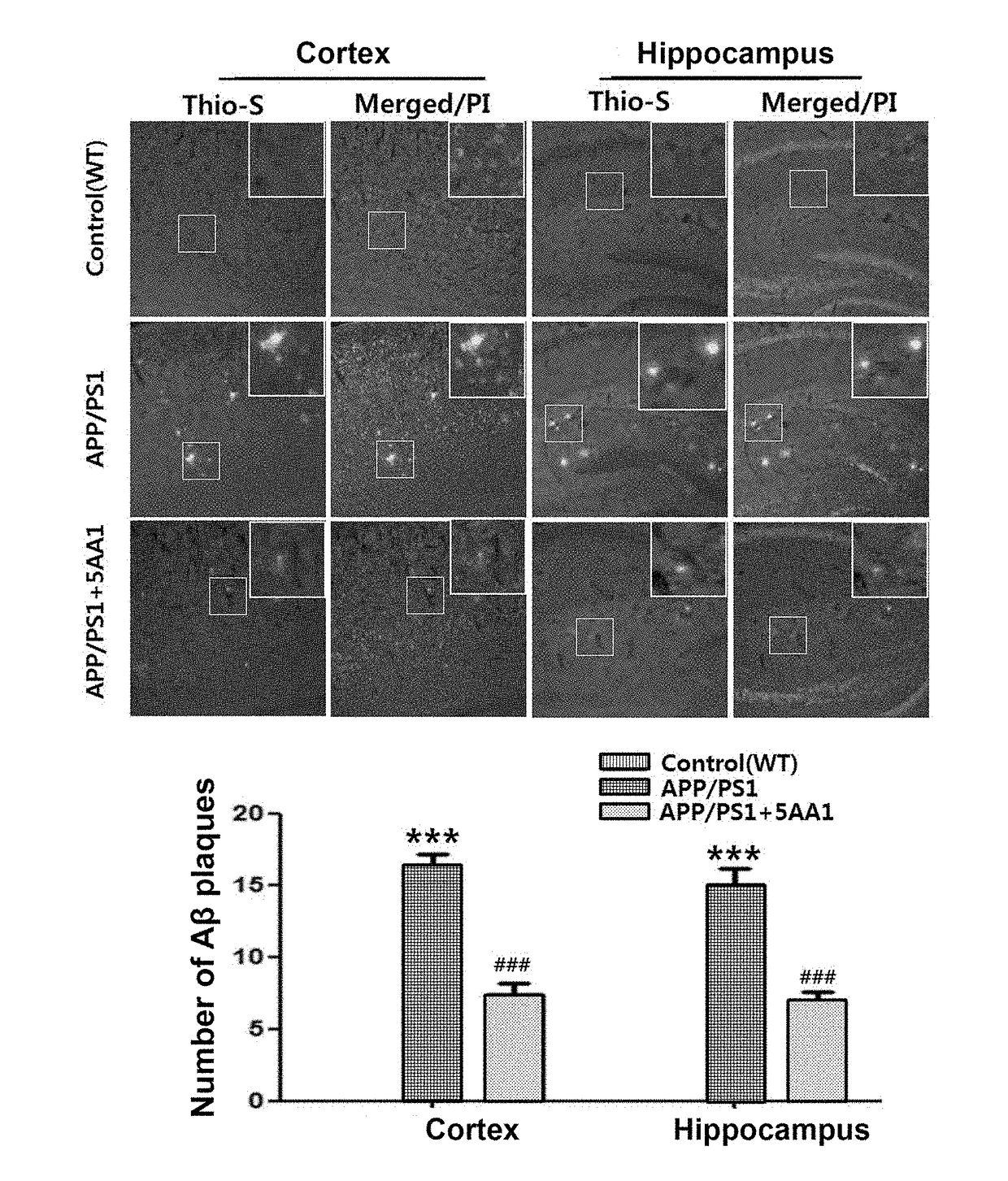 Composition for the prevention, improvement, or treatment of neurological disorder including adiponectin receptor-activating novel peptide as active ingredient