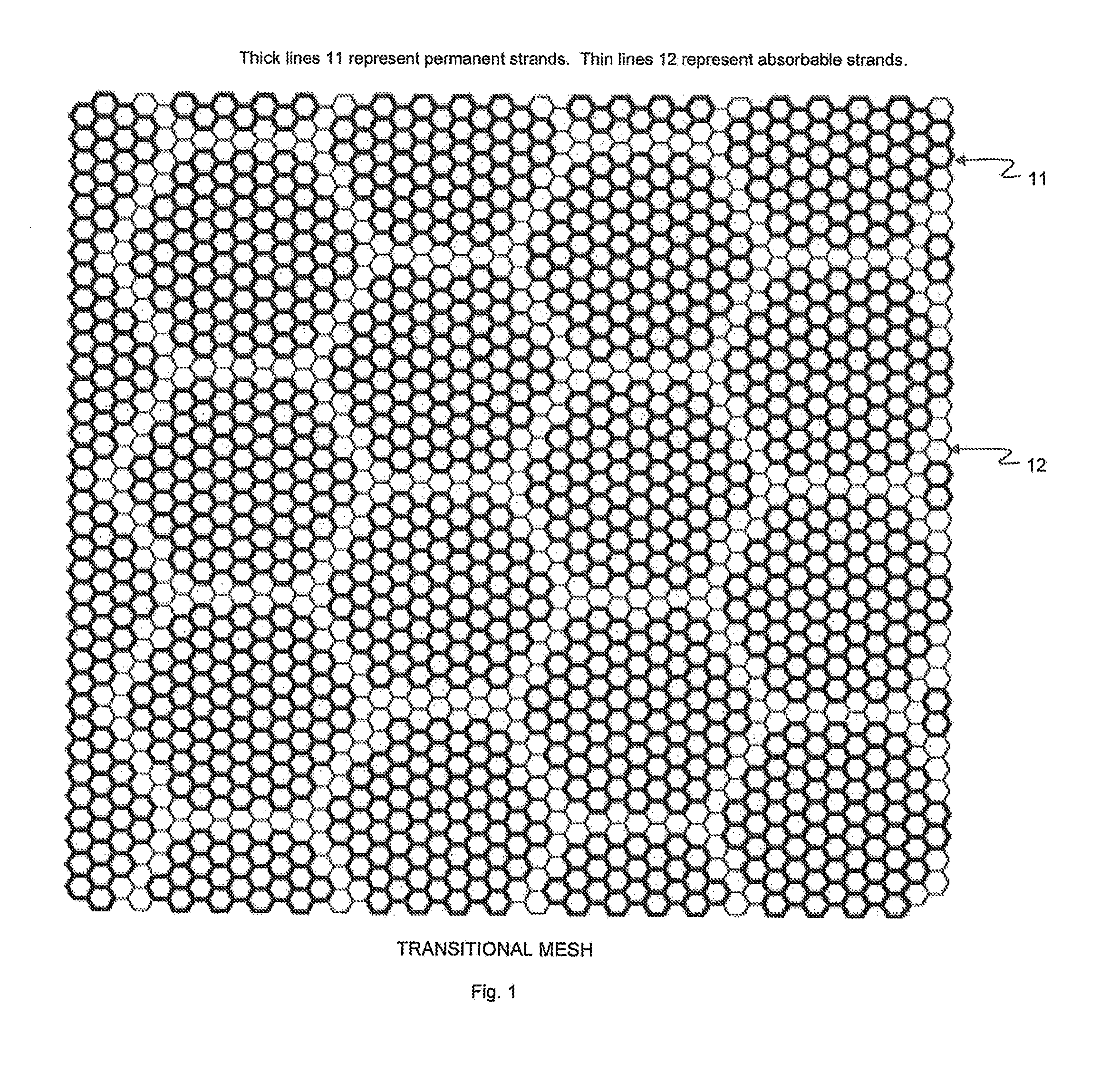 Supporting and Forming Transitional Material for Use in Supporting Prosthesis Devices, Implants and to Provide Structure in a Human Body