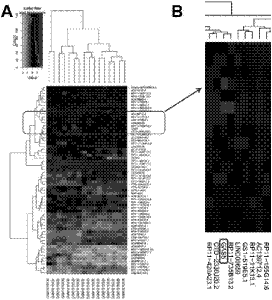 Application of lncRNAGAS5 as age-related macular degeneration diagnostic marker