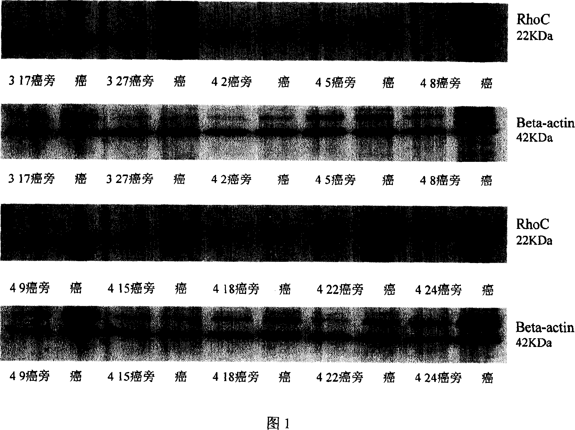 Application of RhoC guanosine triphosphate