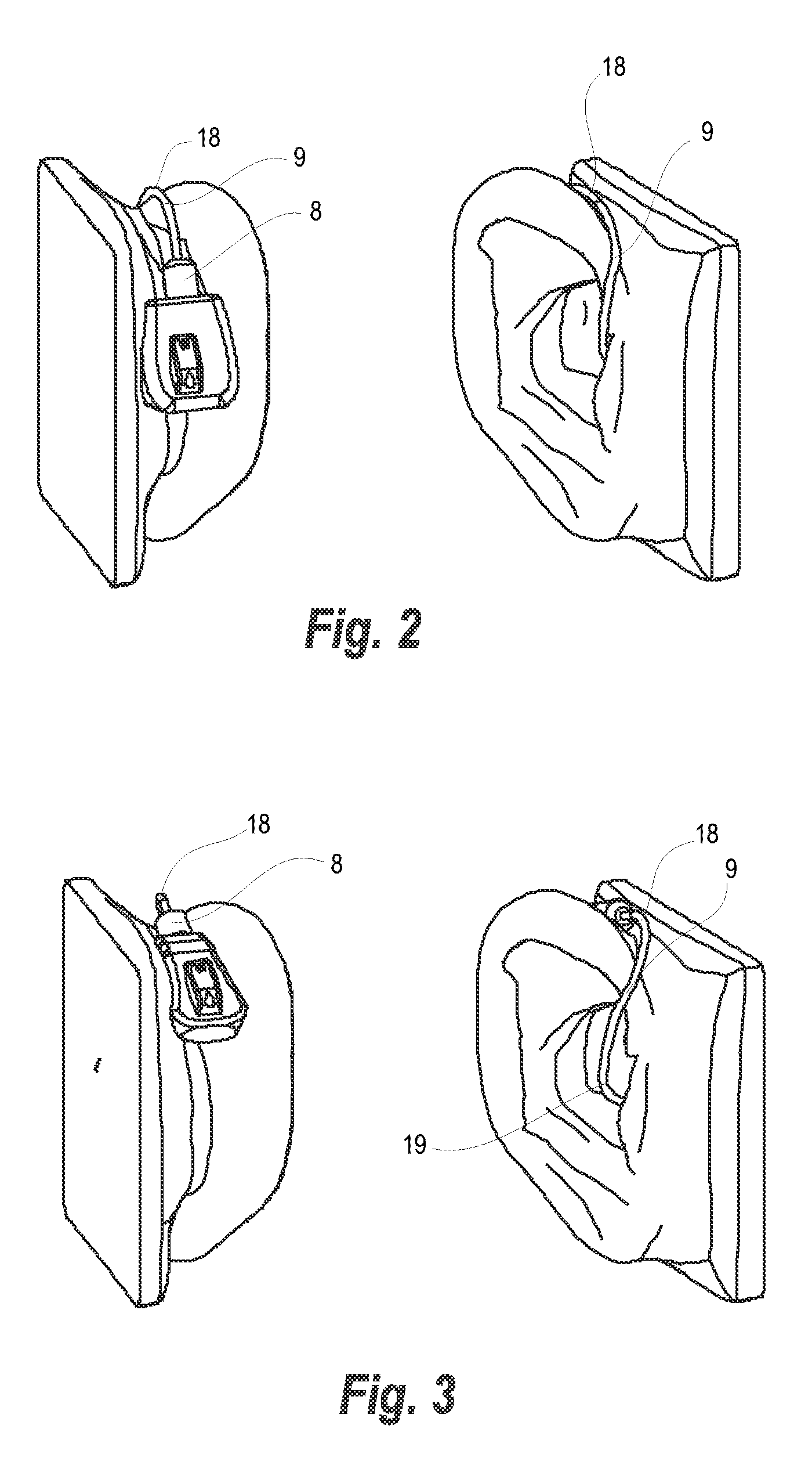 Housing for a hearing aid, hearing aid, and a method of preparing a hearing aid