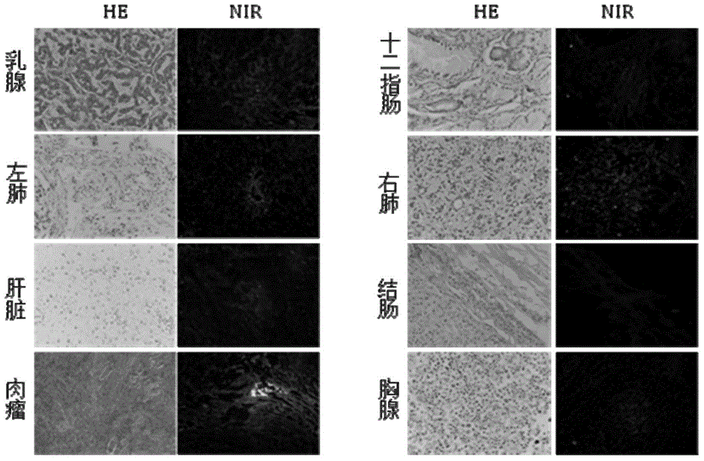Near infrared fluorescent dye with tumor specificity targeting performance and applications thereof