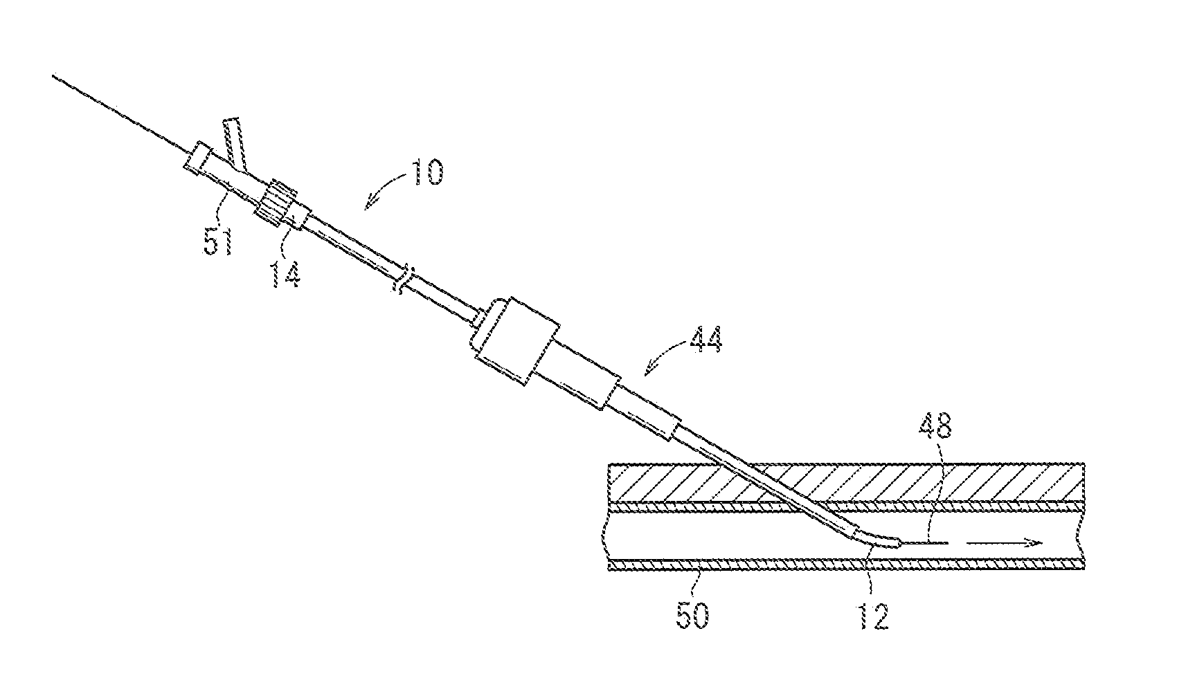Catheter for left coronary artery and engaging method therefor