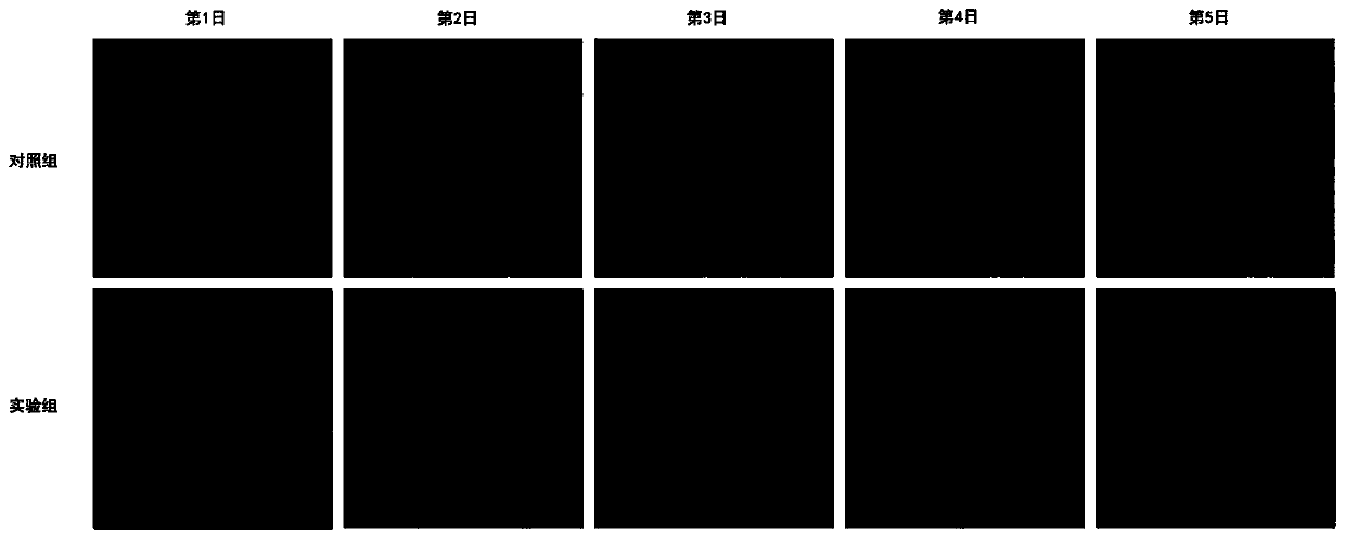 Use of emc8 gene inhibitor in preparation of medicine for treating gastric cancer