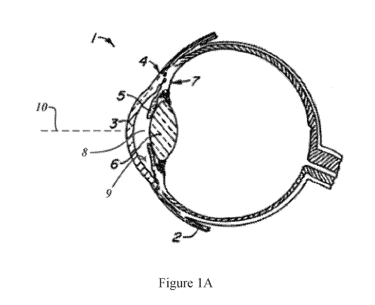 Convex contact probe for the delivery of laser energy