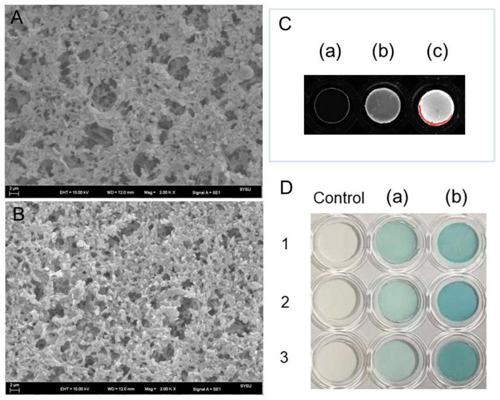 Detection reagent and detection method for Zika virus