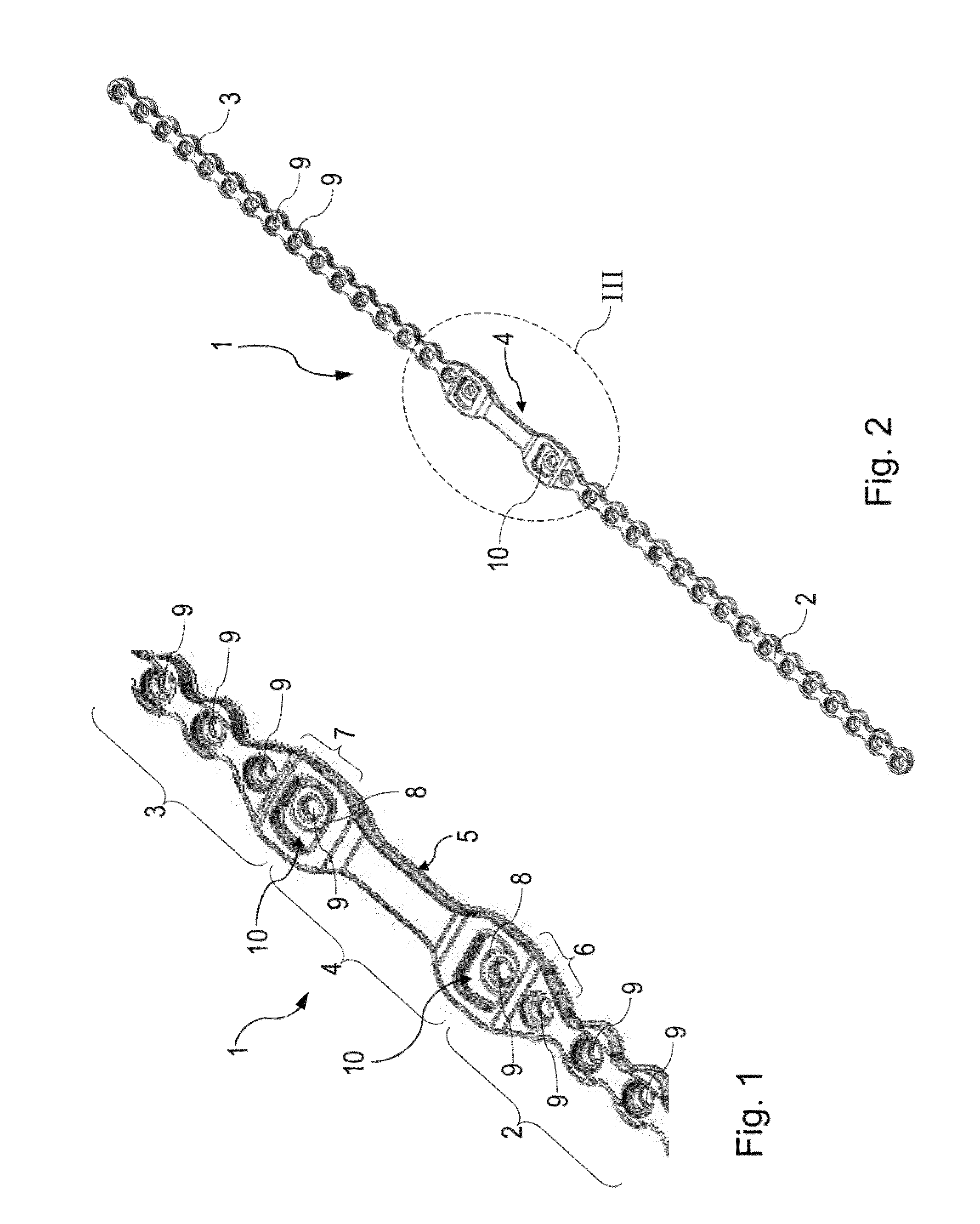 Sternal plate type sternal closure comprising an integral severing site member