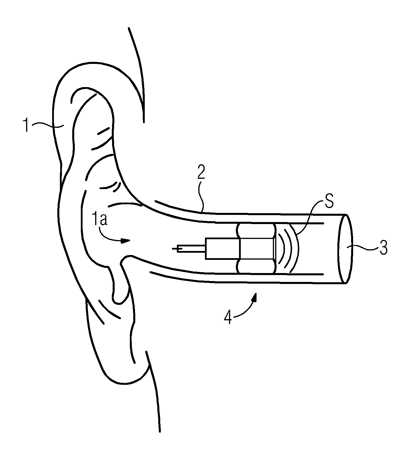 Inflatable ear mold connection system