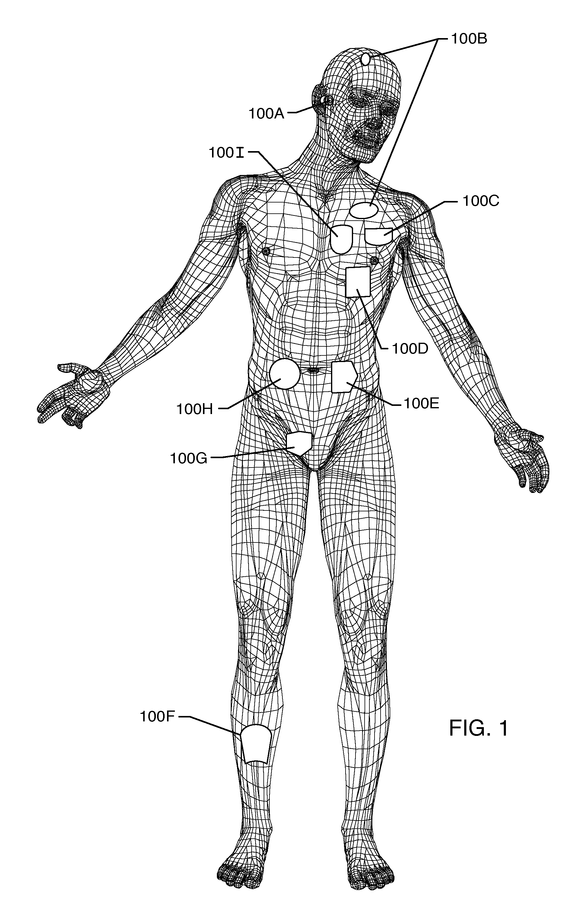Modular EMI filtered terminal assembly for an active implantable medical device