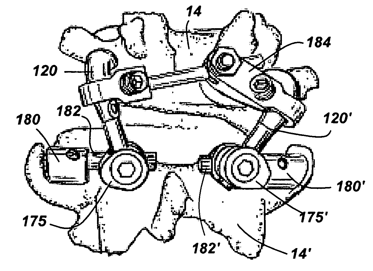 Arthroplasty revision system and method