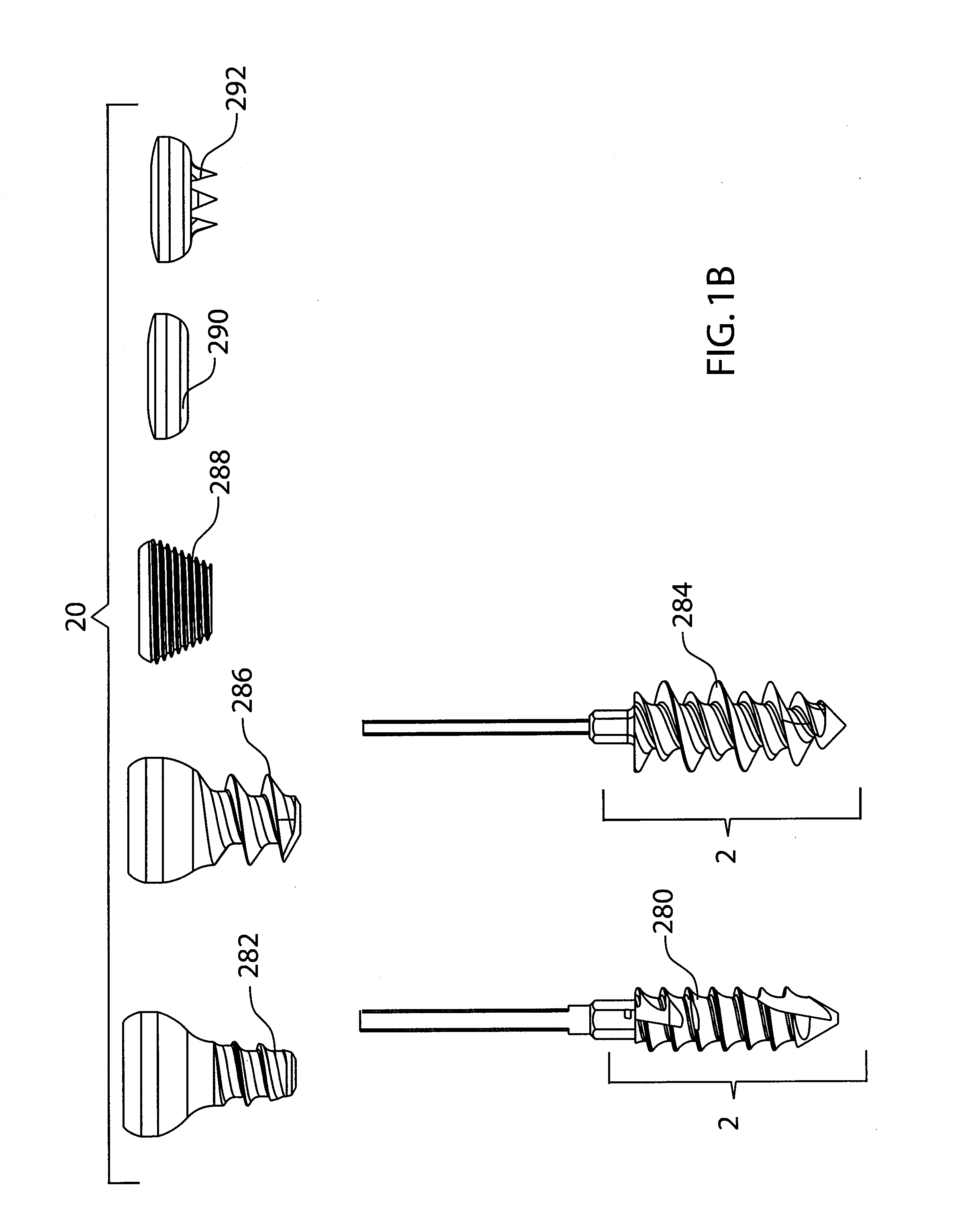 Tensioning system and method for the fixation of bone fractures