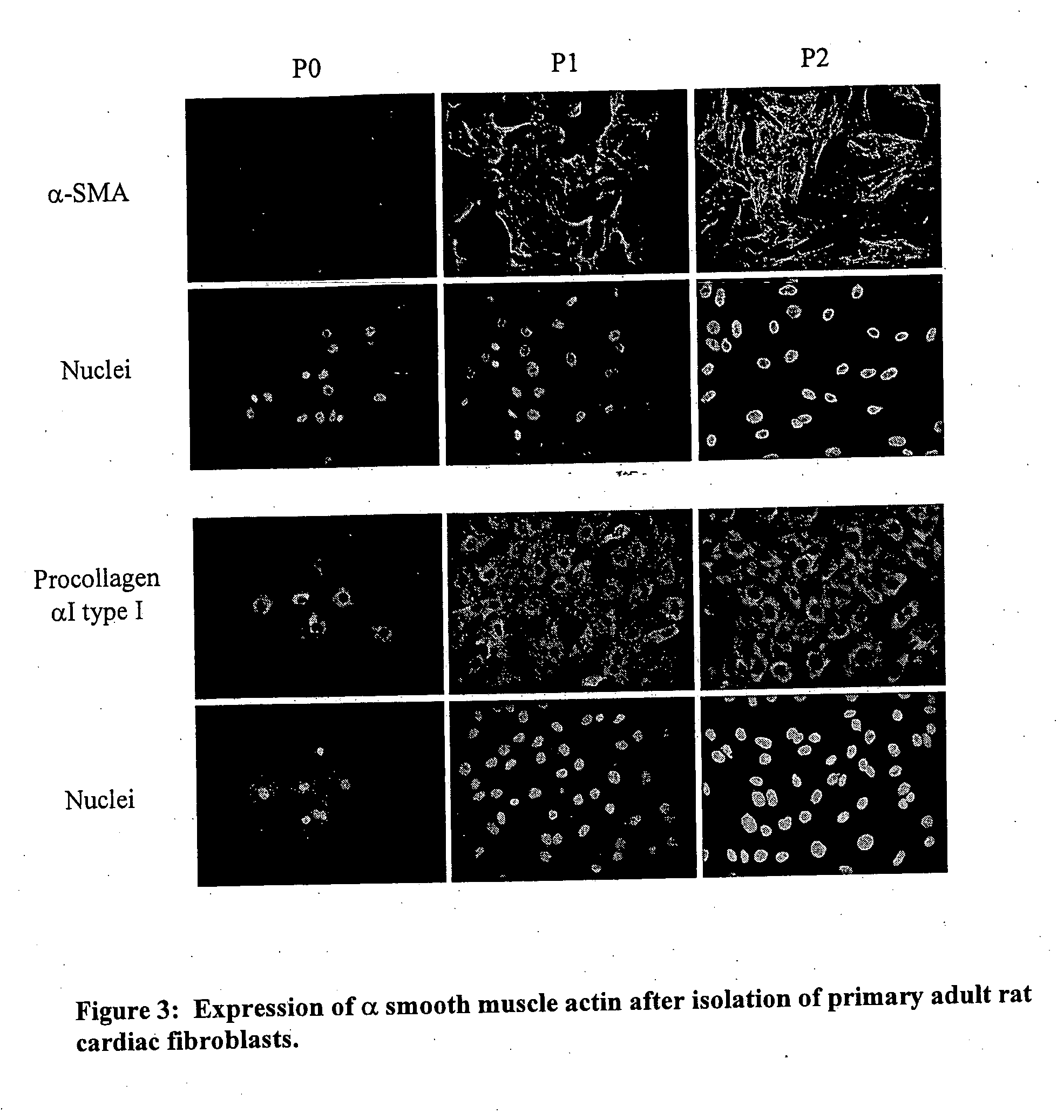 Use of cardiotrophin-1 to promote wound healing and counteract overt fibrosis