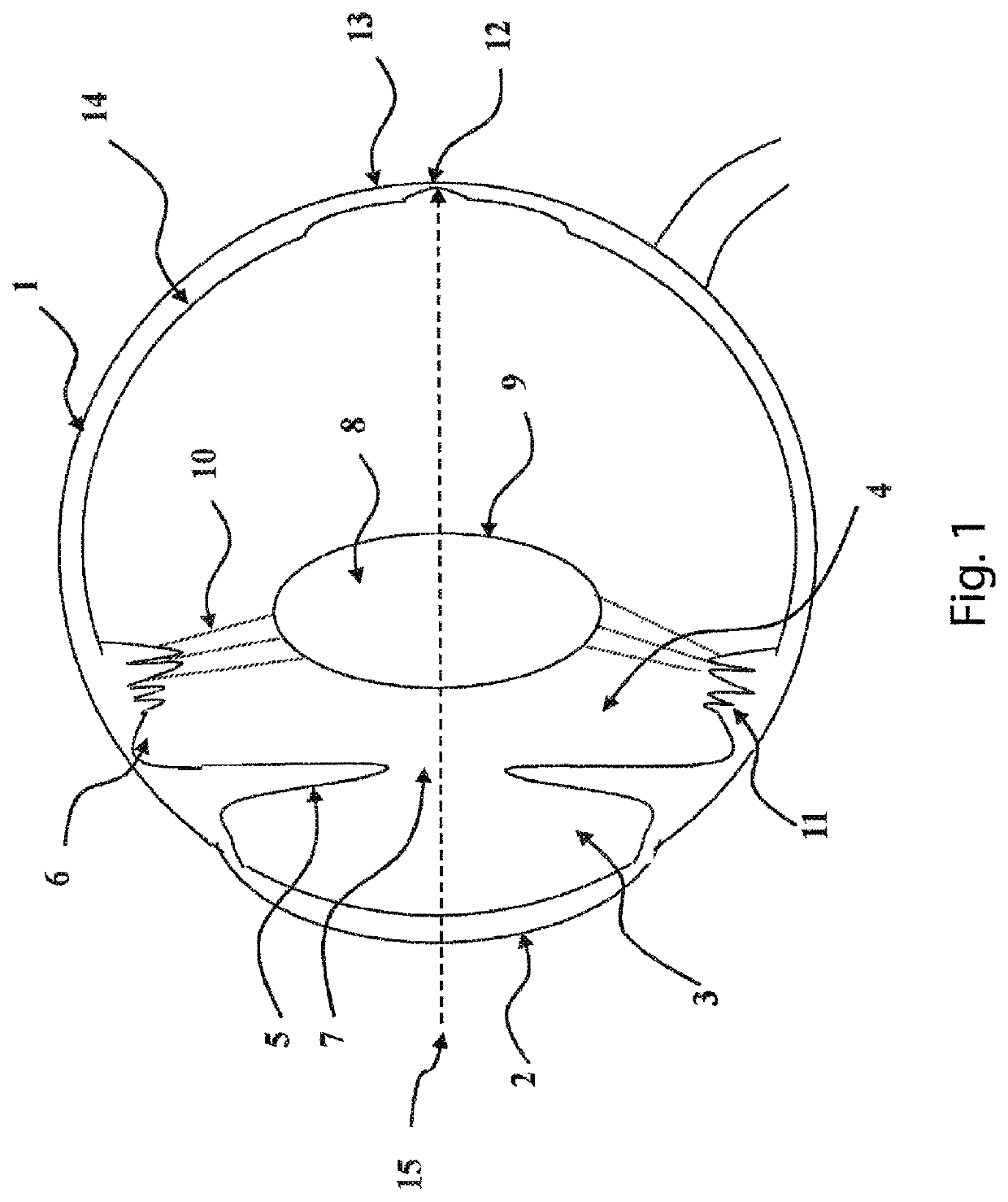 Intraocular lens system