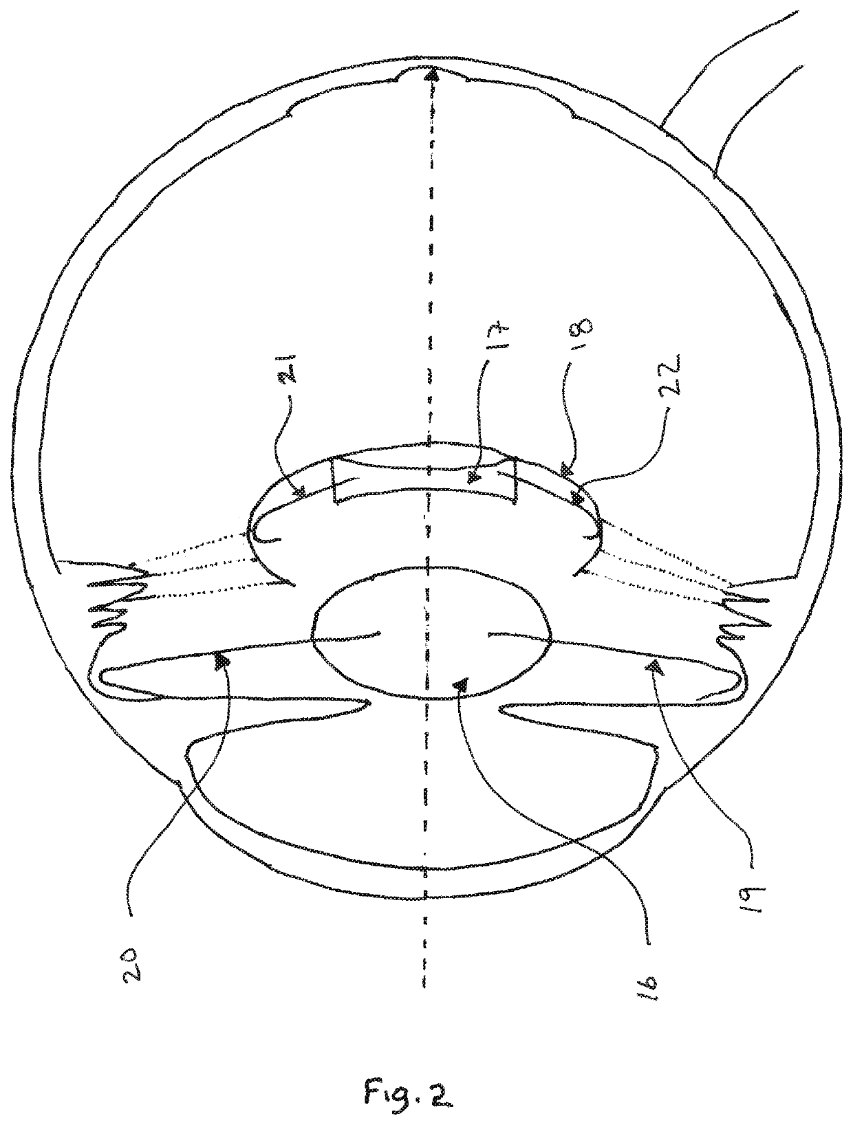 Intraocular lens system