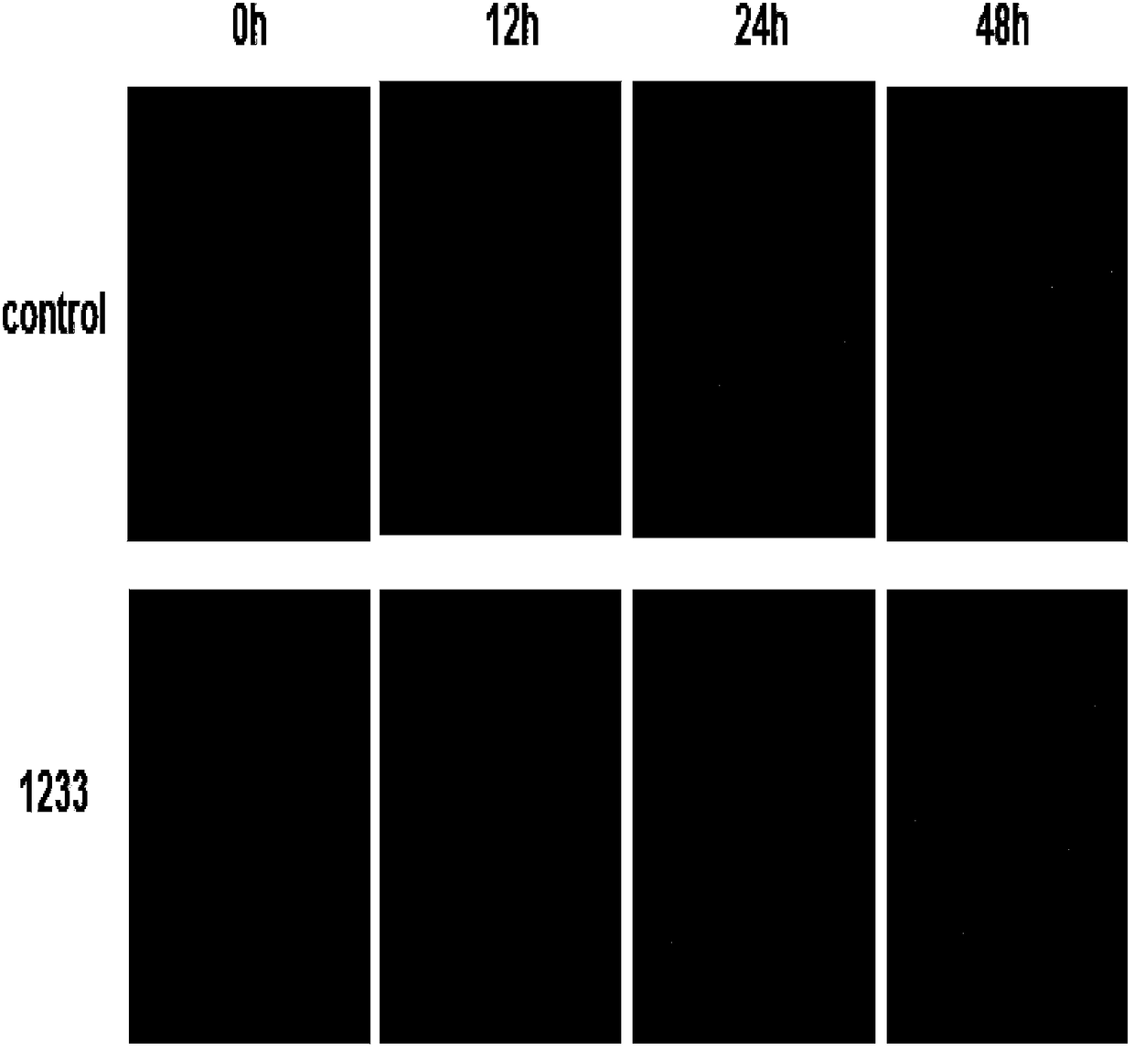 An application of a transcription factor Spl specific inhibitor in preparation of medicines treating uveal melanoma