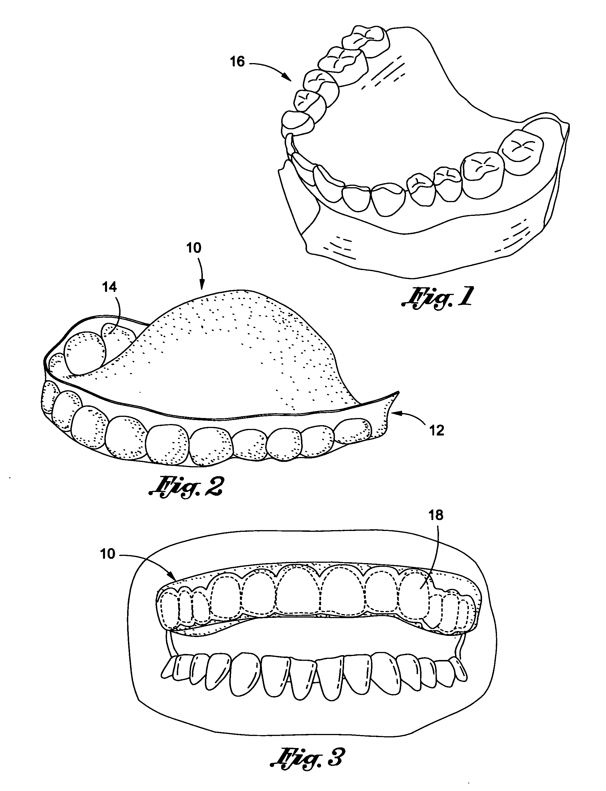 Dental appliance, oral care product and method of preventing dental disease