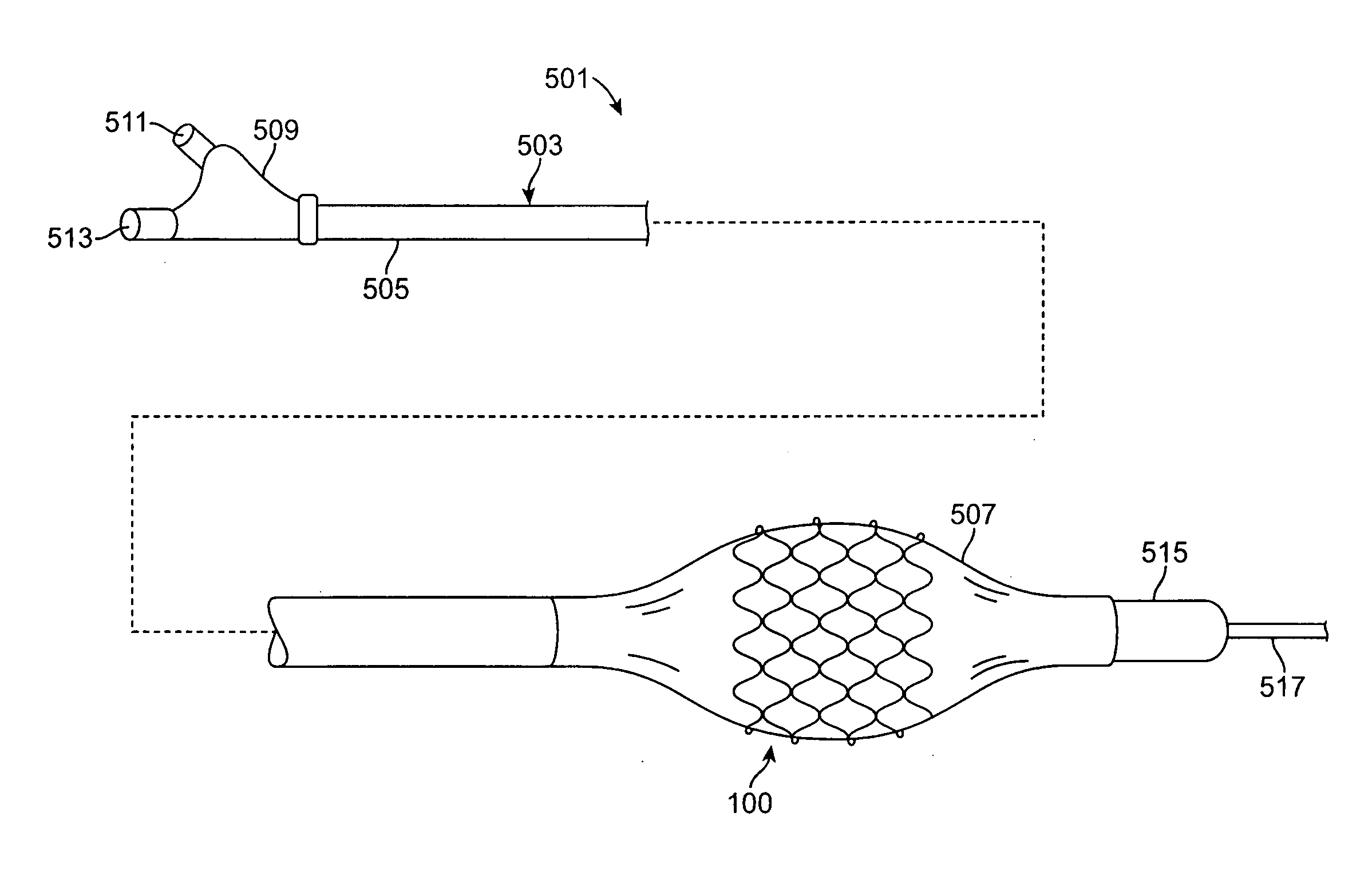 Method for Tracking Degradation of a Biodegradable Stent Having Superparamagnetic Iron Oxide Particles Embedded Therein