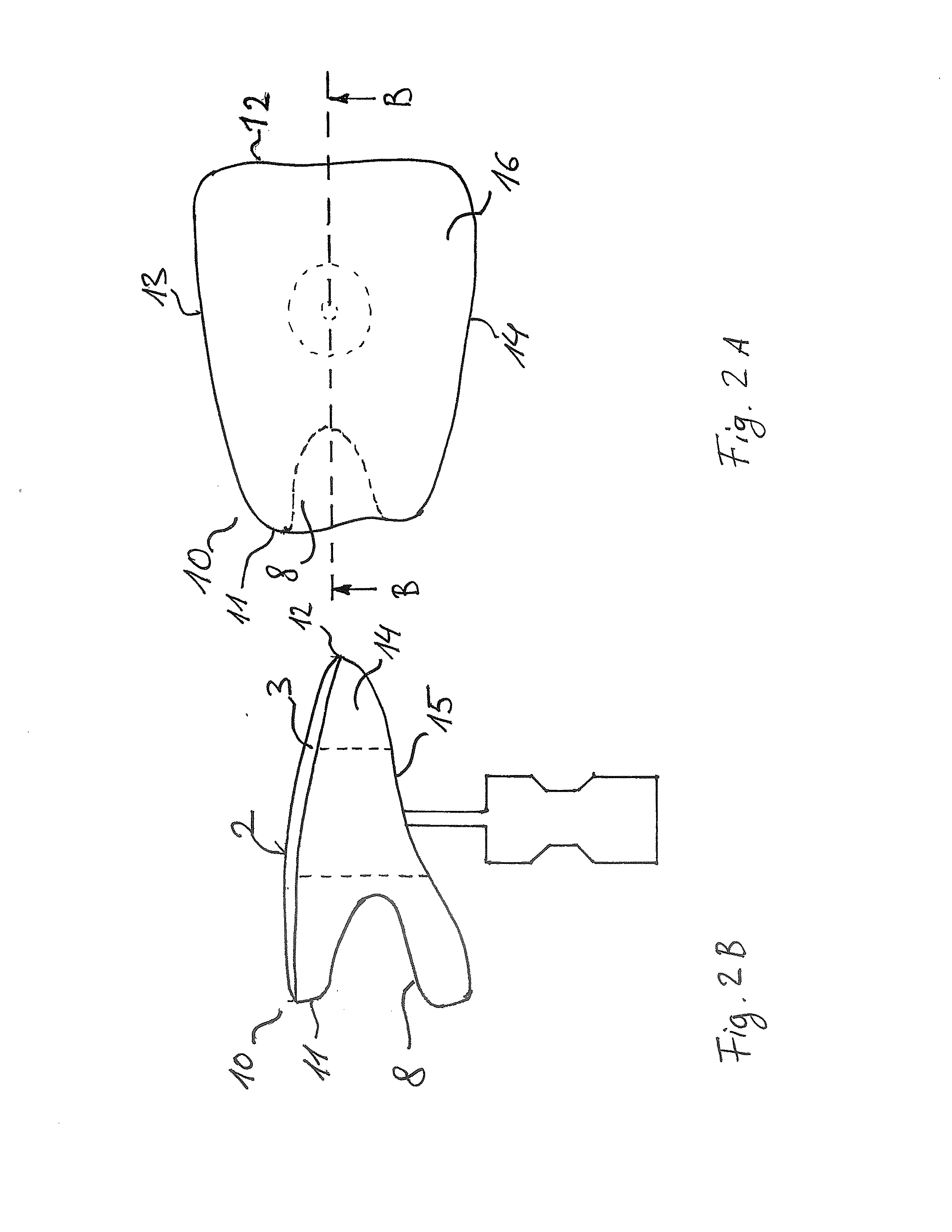 Method, blank, assortment of blanks, dental database and blank database comprising prefabricated partial end surfaces of partial dentures