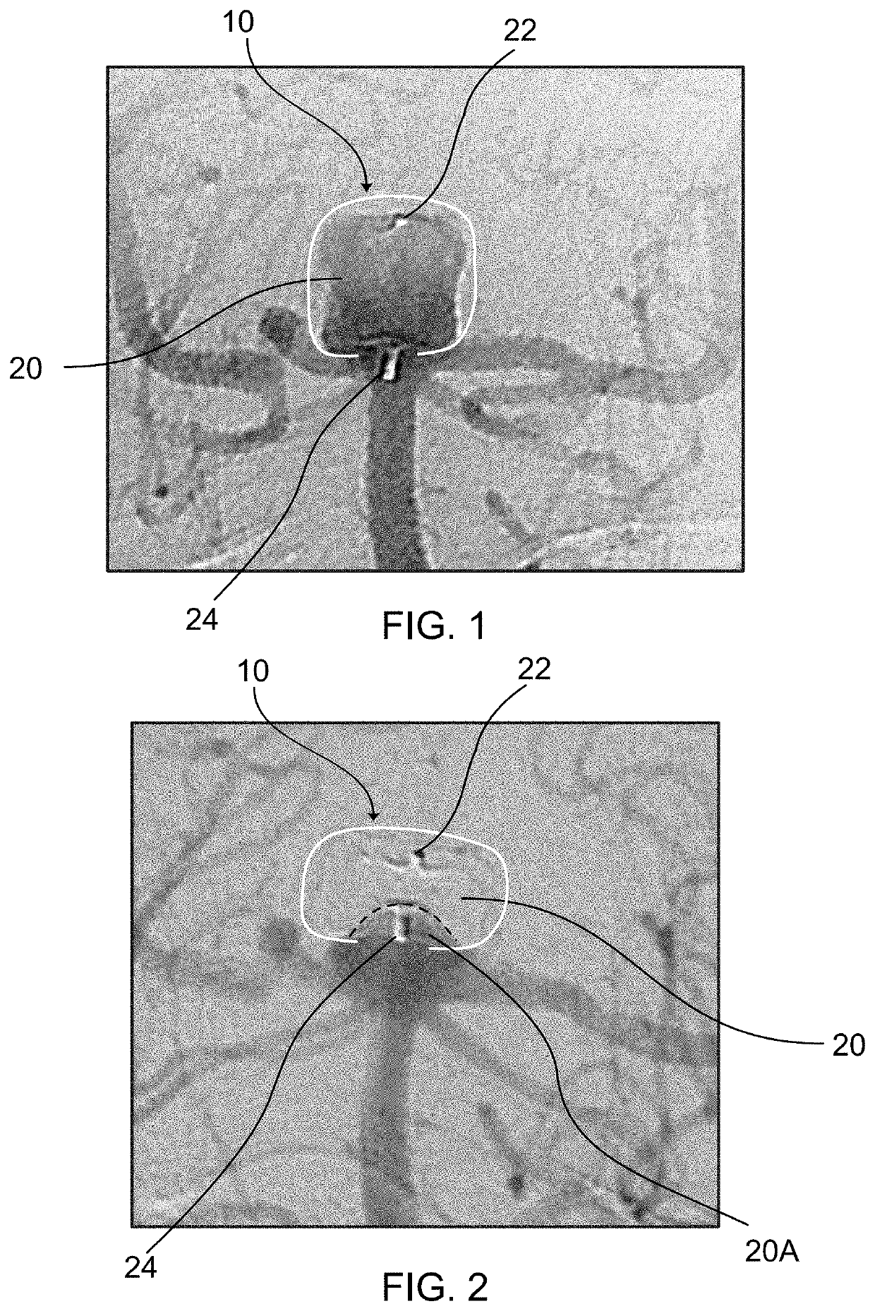 Medical Devices With Sensing Characteristics For Intravascular Treatment Sites And Methods Thereof