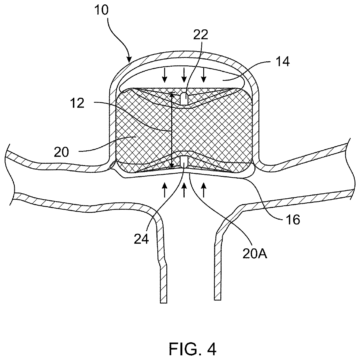 Medical Devices With Sensing Characteristics For Intravascular Treatment Sites And Methods Thereof