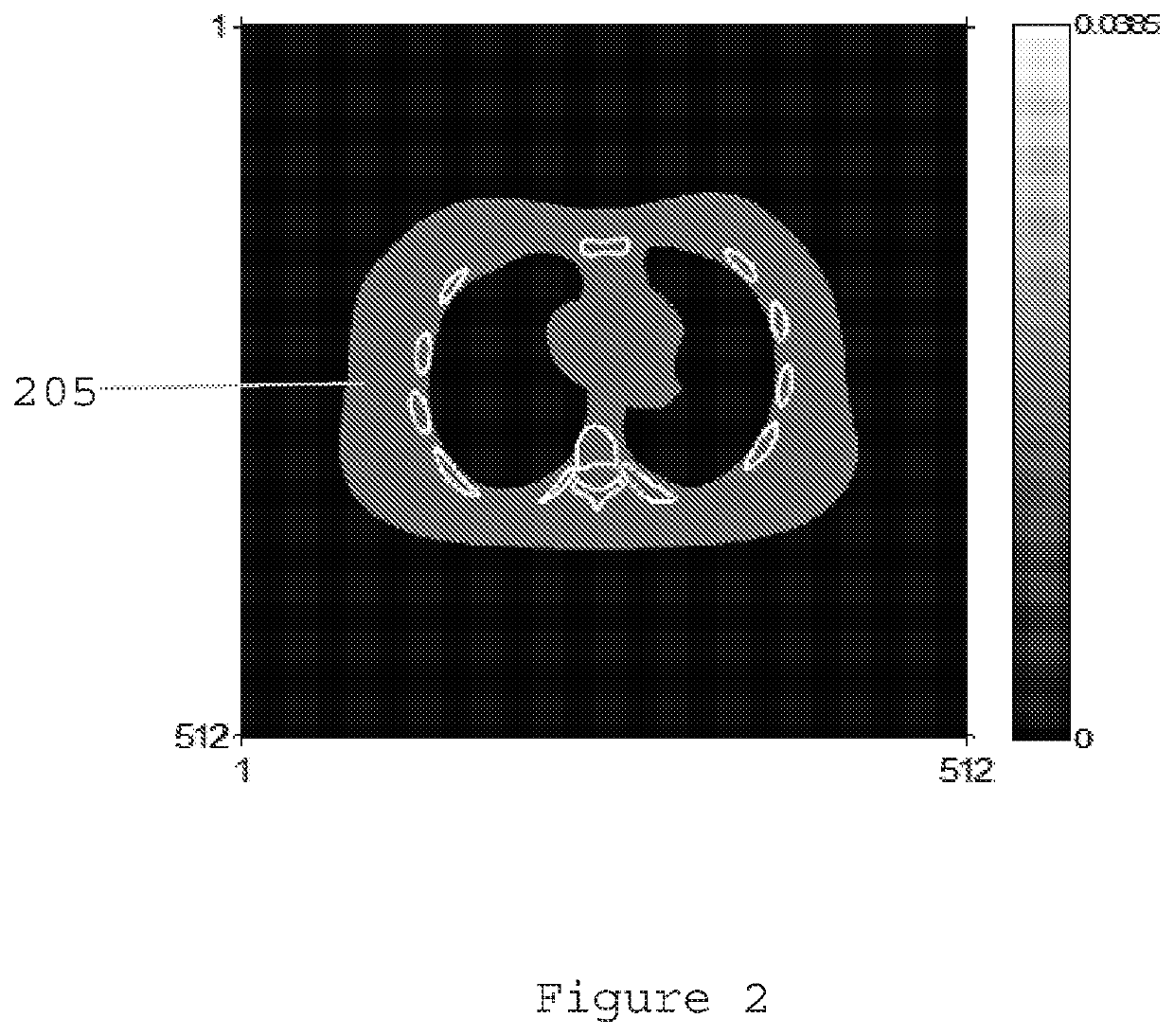 System, method and computer-accessible medium for ultralow dose computed tomography image reconstruction