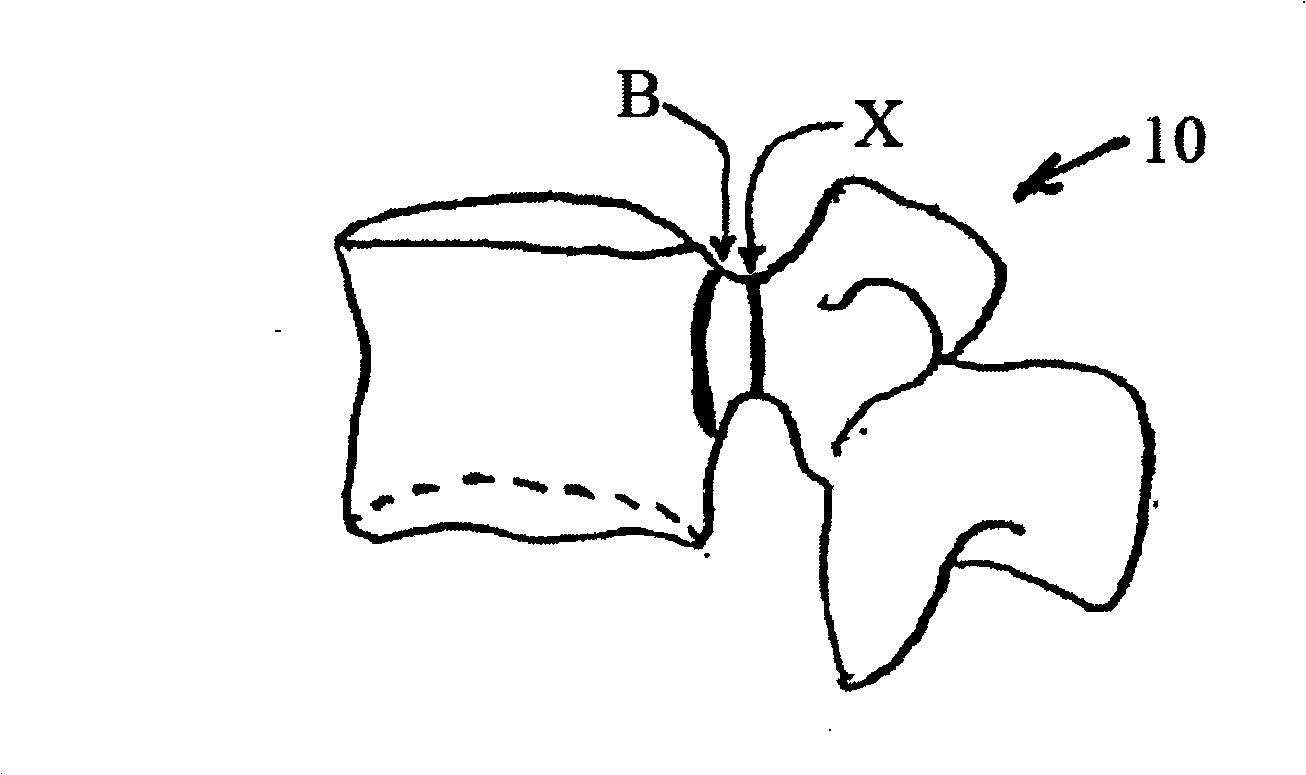 Methods for determining pedicle base circumference, pedicle isthmus and center of the pedicle isthmus