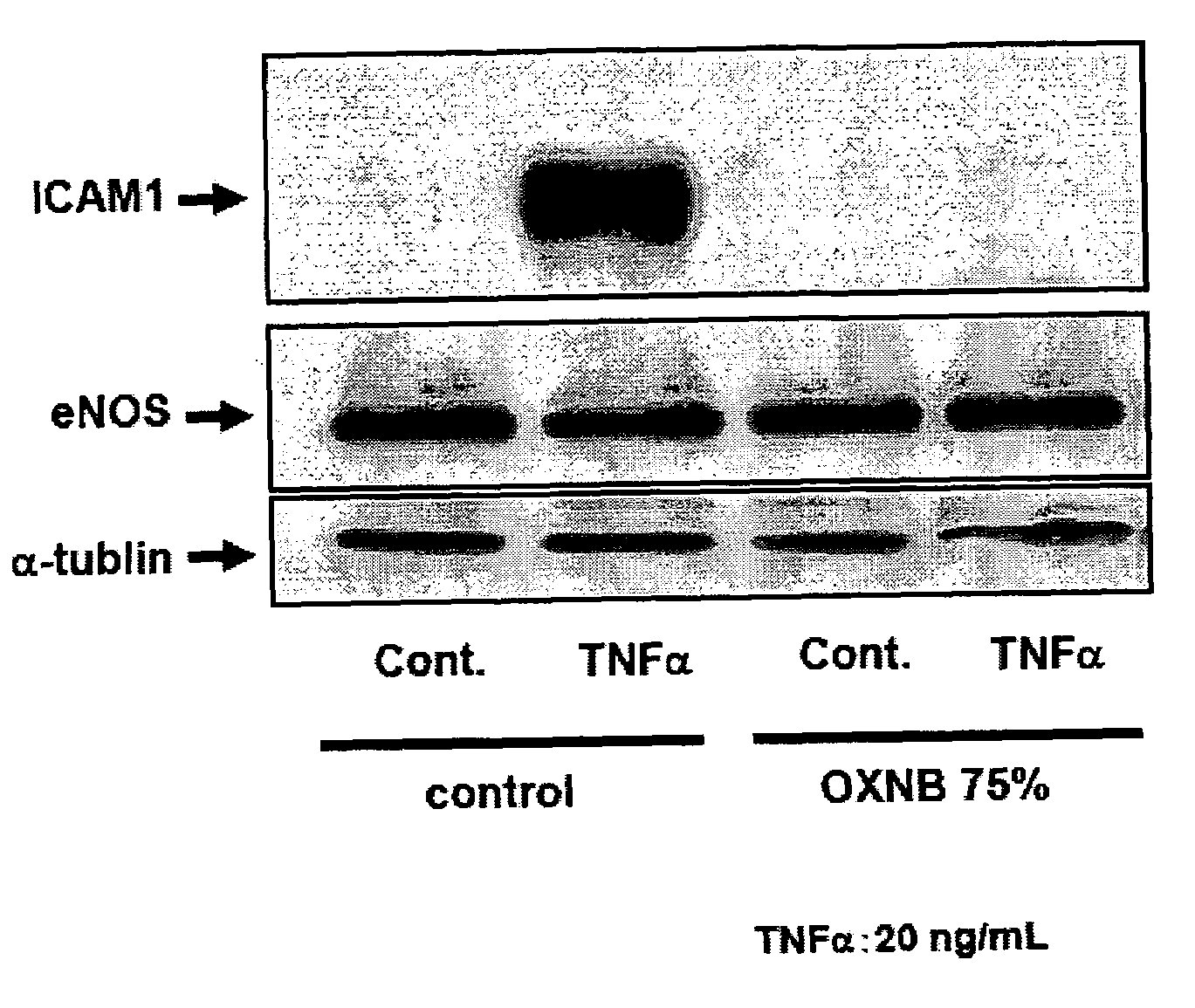 Medical agent for preventing or treating diseases resulting from one of inflammation and remodeling, and method for preventing or treating the diseases