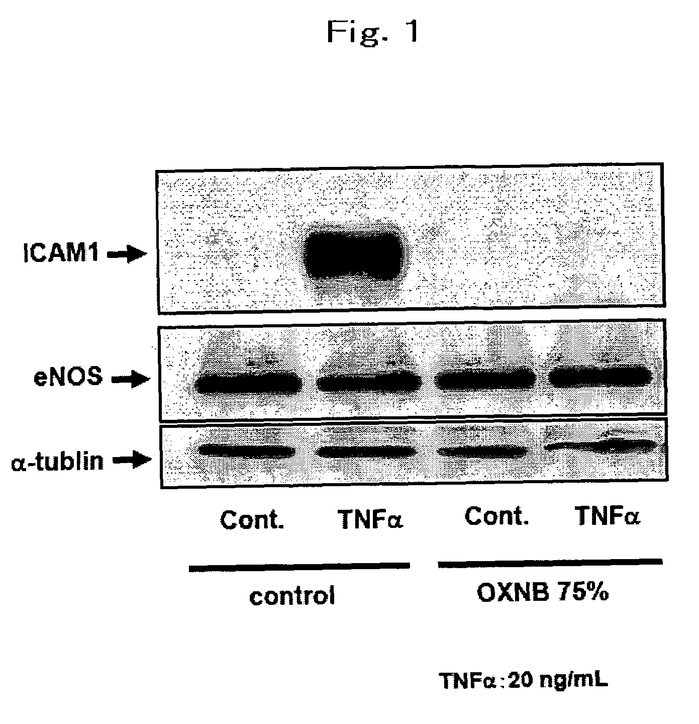 Medical agent for preventing or treating diseases resulting from one of inflammation and remodeling, and method for preventing or treating the diseases