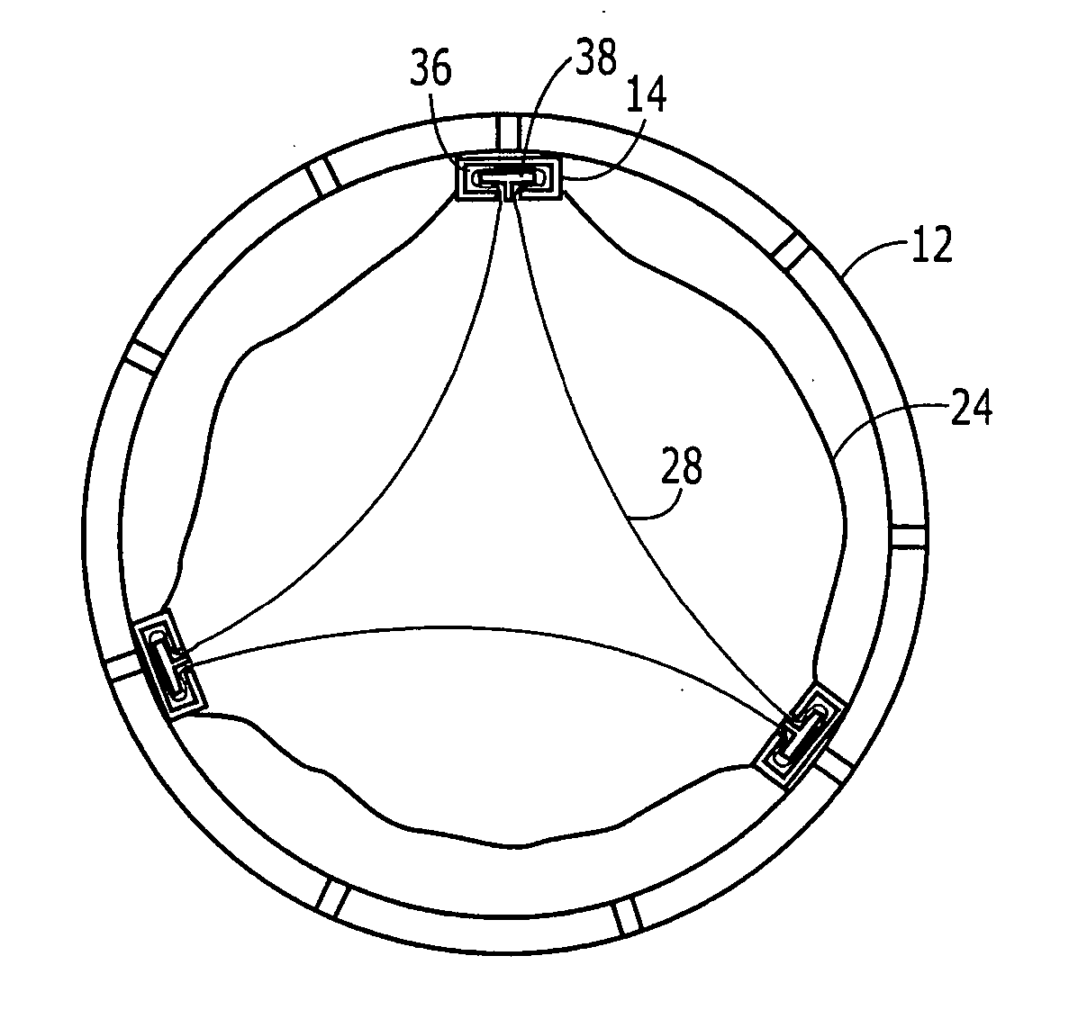 Heart valve and method for insertion of the heart valve into a bodily vessel