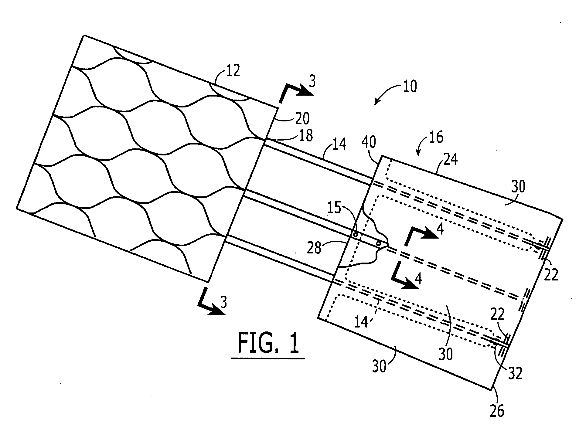 Heart valve and method for insertion of the heart valve into a bodily vessel