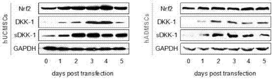 Double-gene co-expression plasmid pIRES2-Nrf2-DKK1, preparation method and application thereof