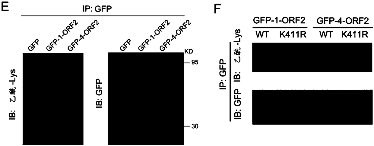 Acetylated HEV (Hepatitis E Virus) capsid protein ORF2 (Open Reading Frame 2) and application thereof