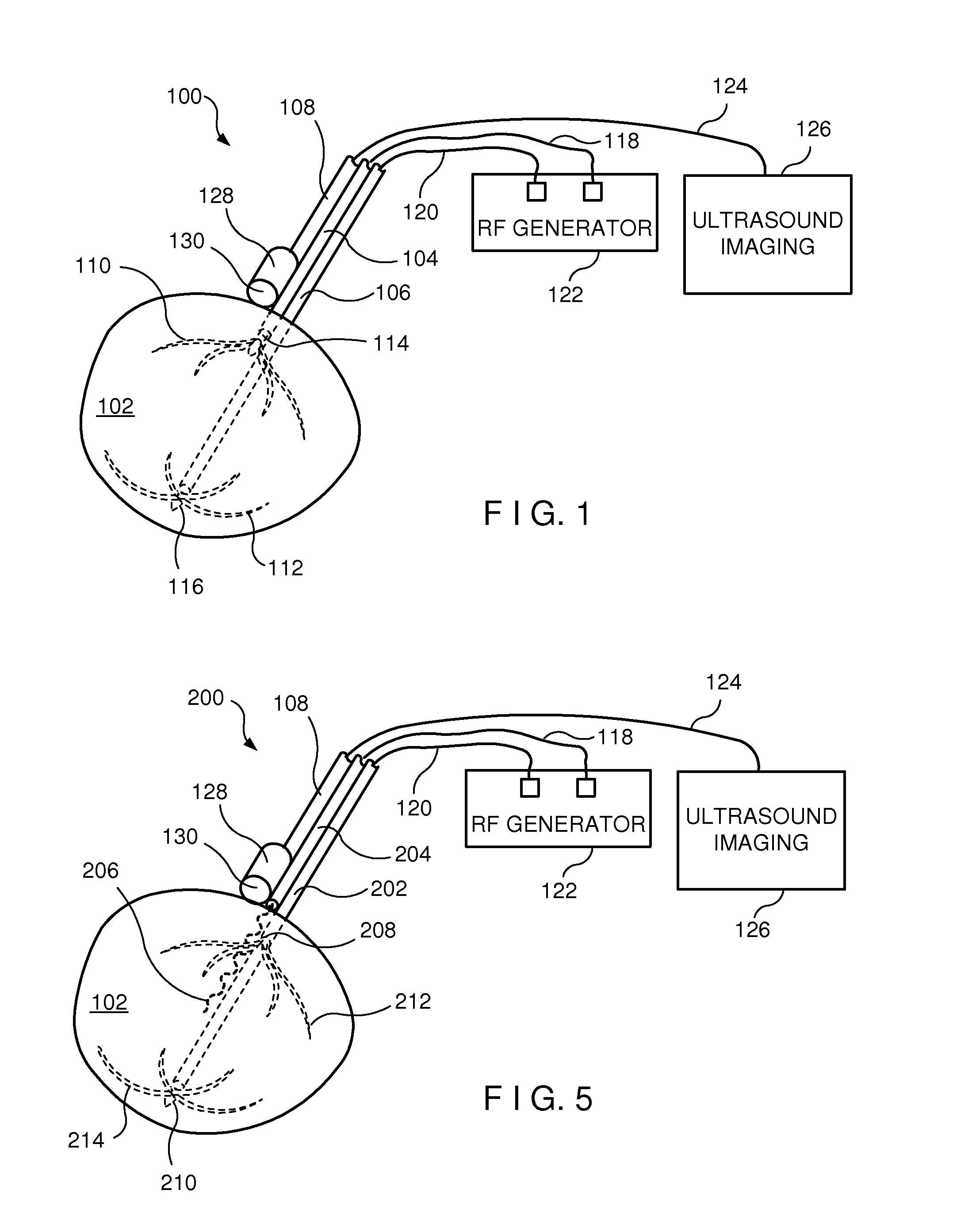 Radio frequency ablation system with integrated ultrasound imaging