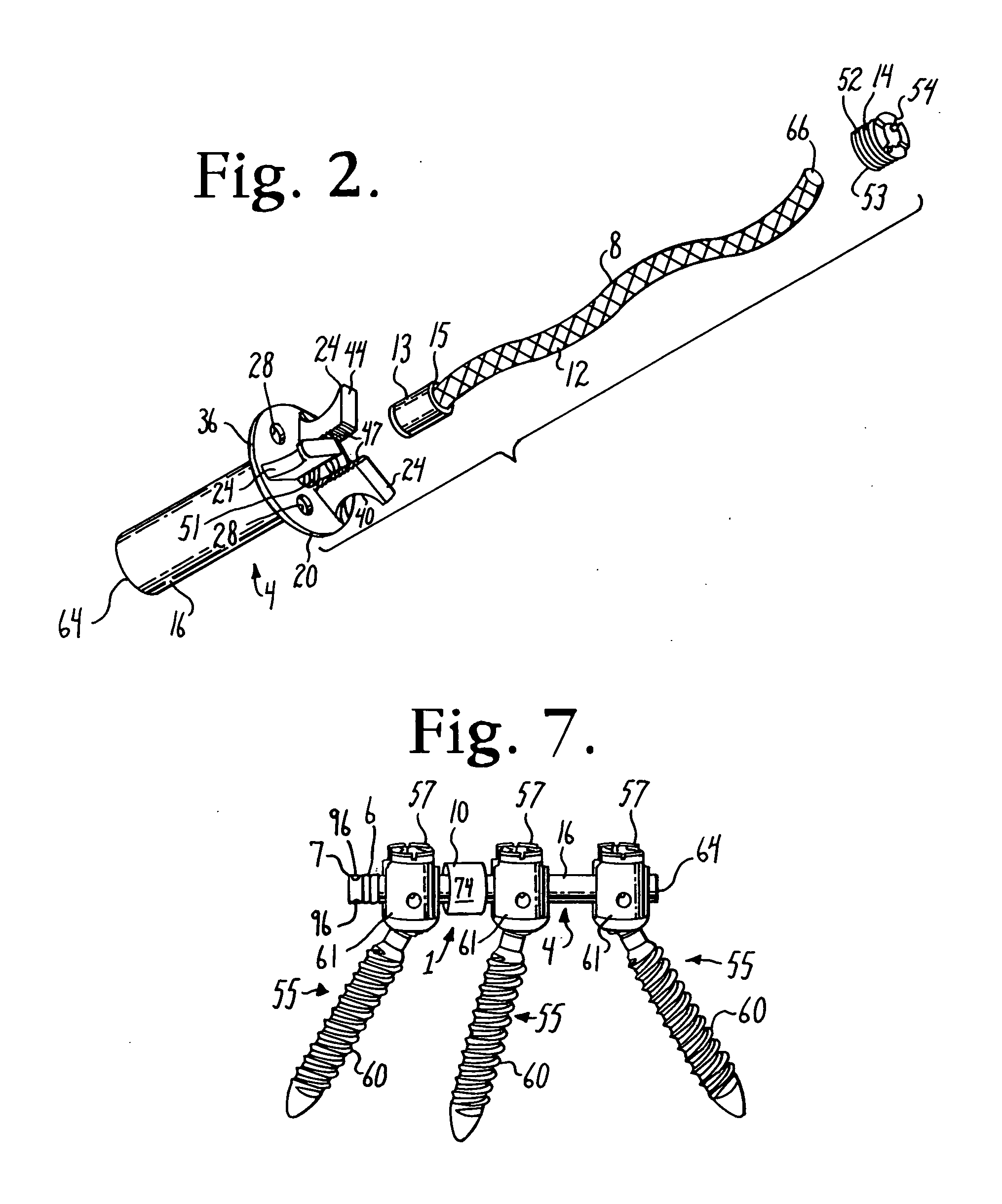 Dynamic stabilization member with fin support and cable core extension