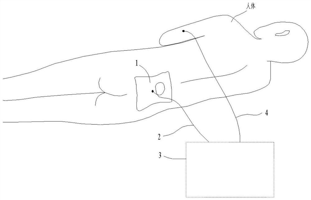 A comprehensive nursing intervention device for cerebrospinal fluid drainage in lumbar pool