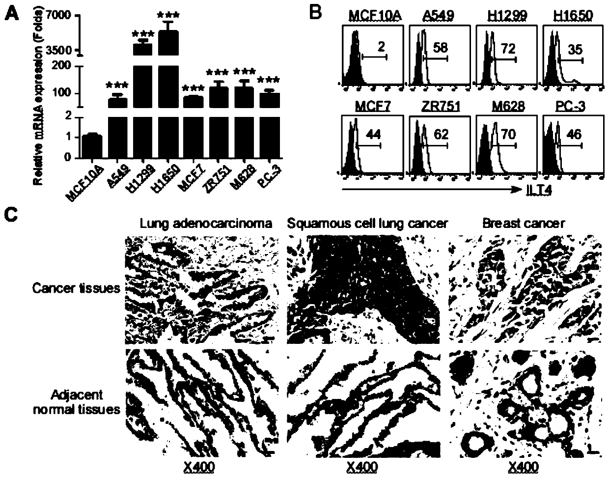 Applications of ILT4 in tumor diagnosis and treatment