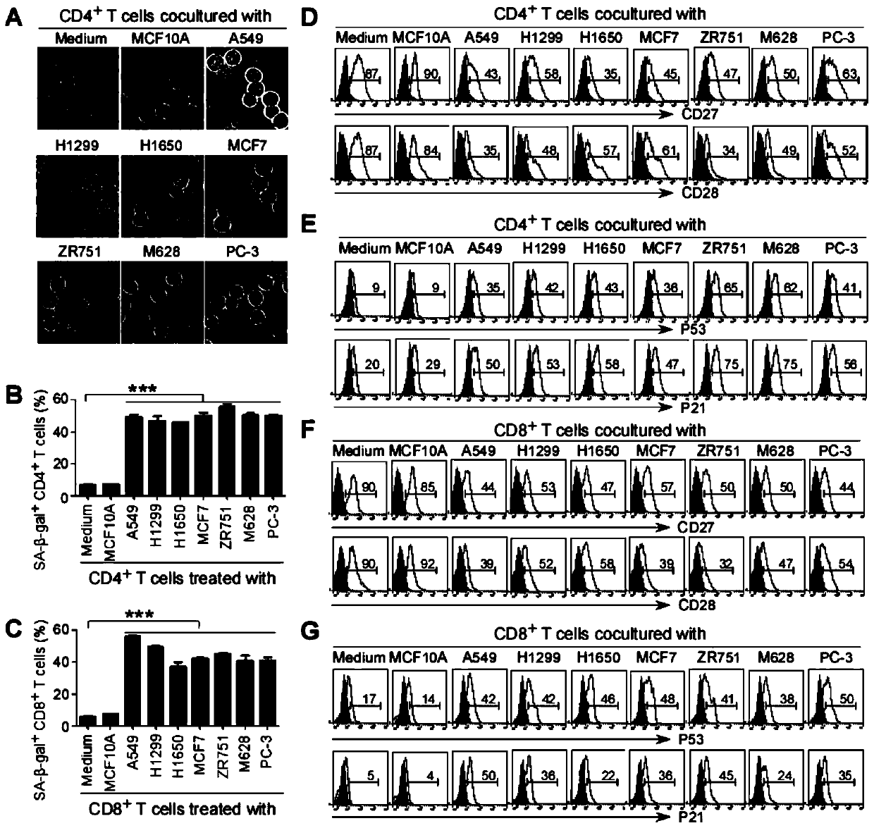 Applications of ILT4 in tumor diagnosis and treatment