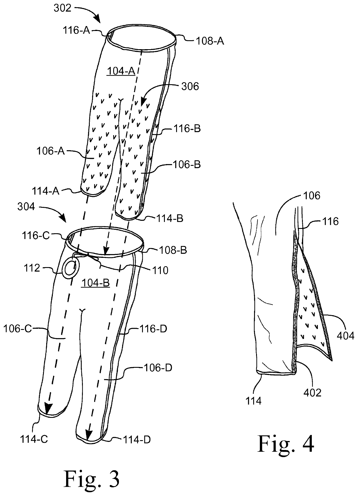 Garment for preventing redistribution hypothermia