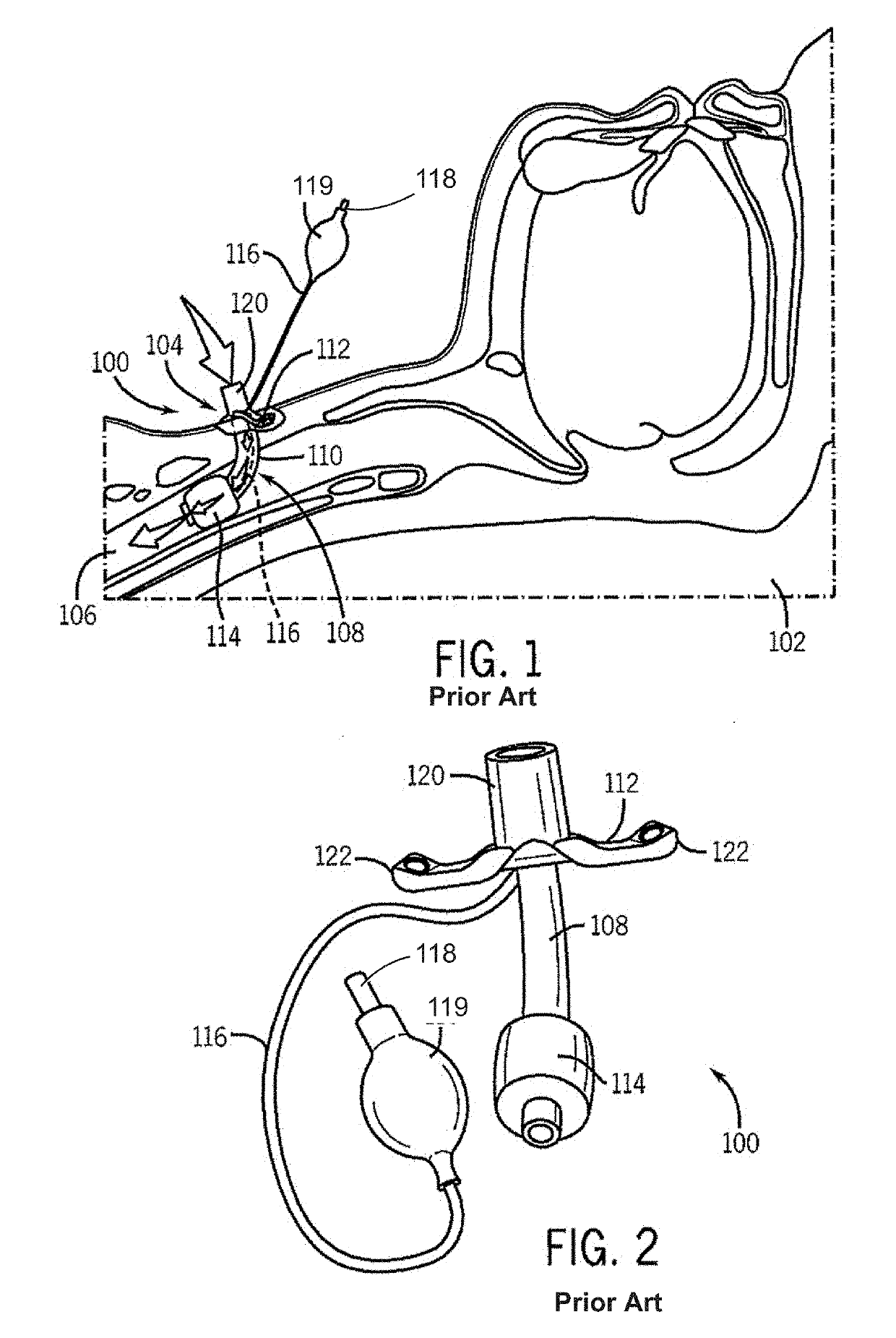 Pressure controller and tracheal breathing tube comprising same