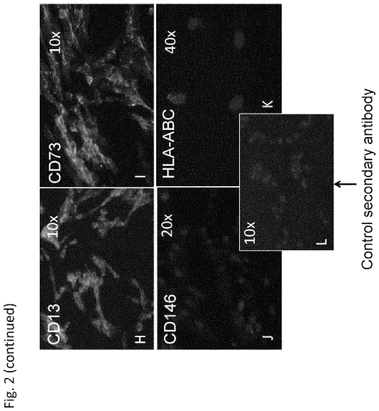 Stem cells expressing mesenchymal and neuronal markers, compositions thereof, and methods of preparation thereof