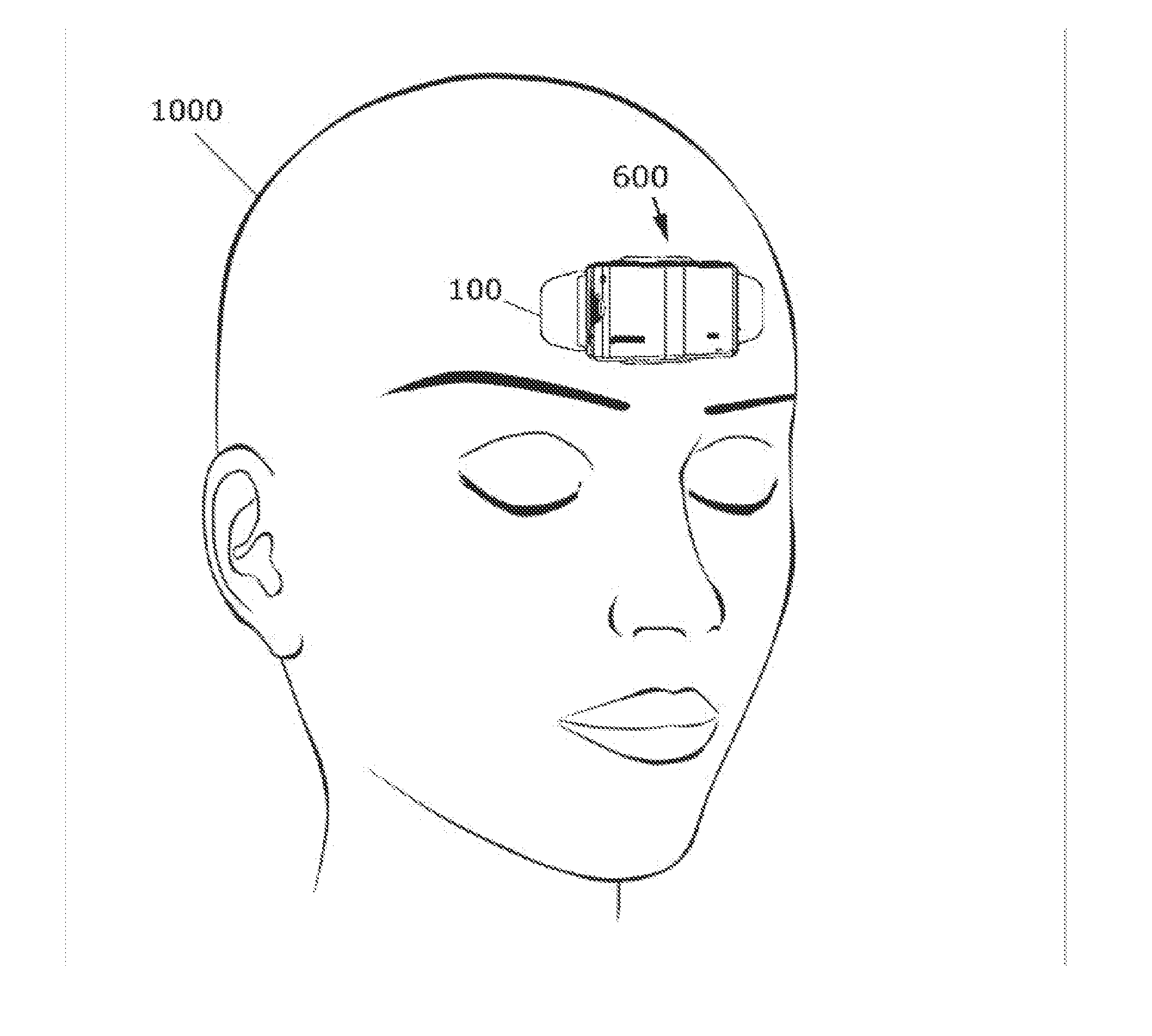 Adhesive-Mountable Head-Wearable EEG Apparatus